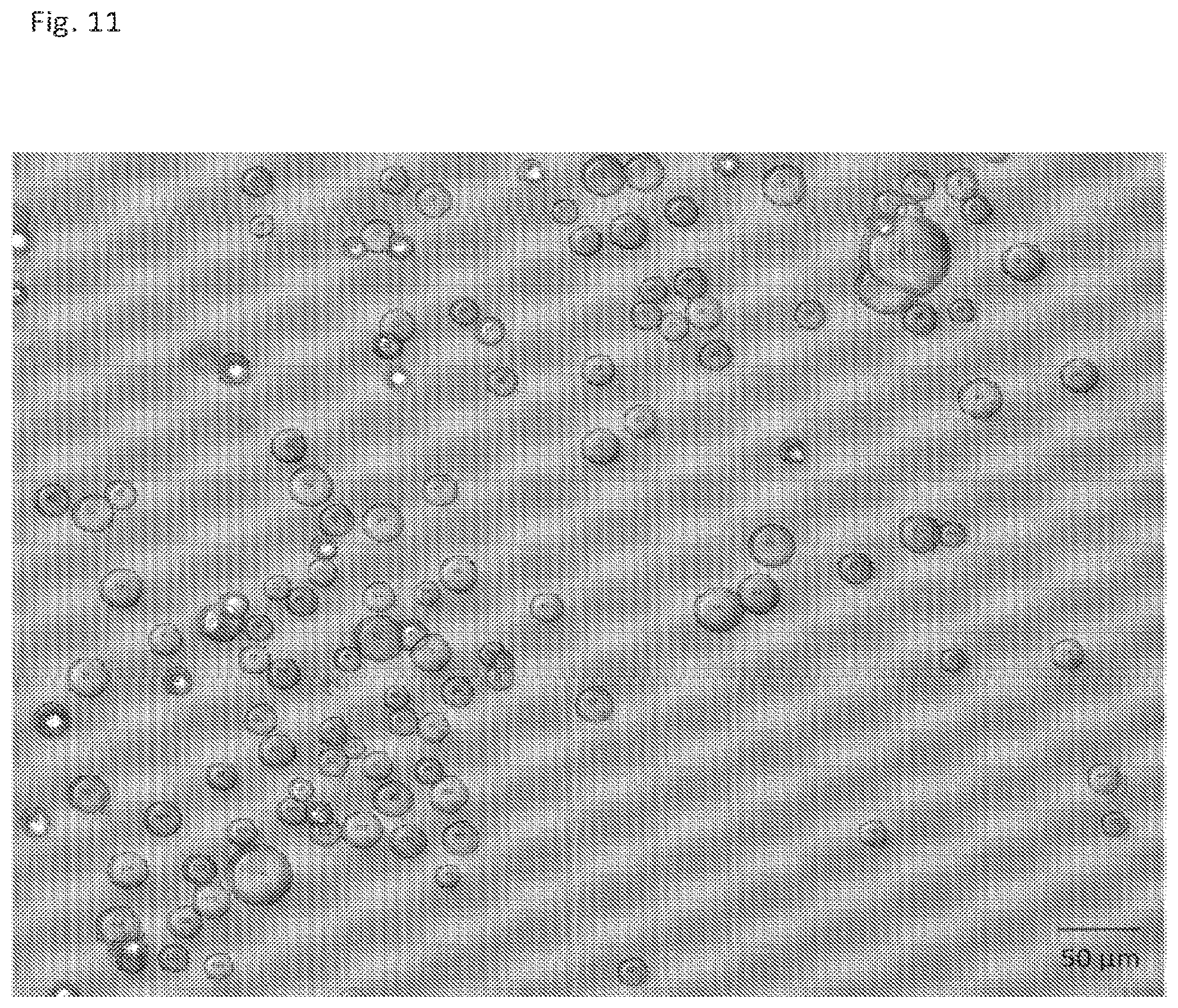Patent US12569445 Figure 11 – Particles comprising a therapeutic or diagnostic agent and suspensions and methods of use thereof