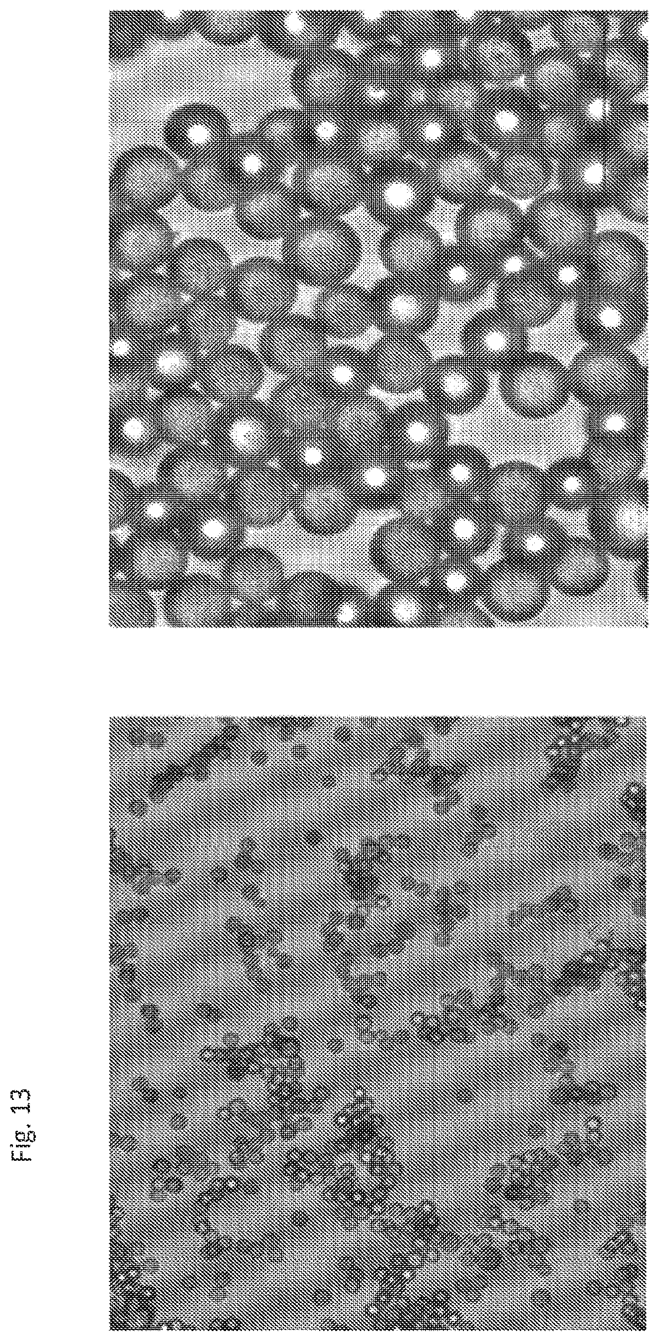 Patent US12569445 Figure 13 – Particles comprising a therapeutic or diagnostic agent and suspensions and methods of use thereof