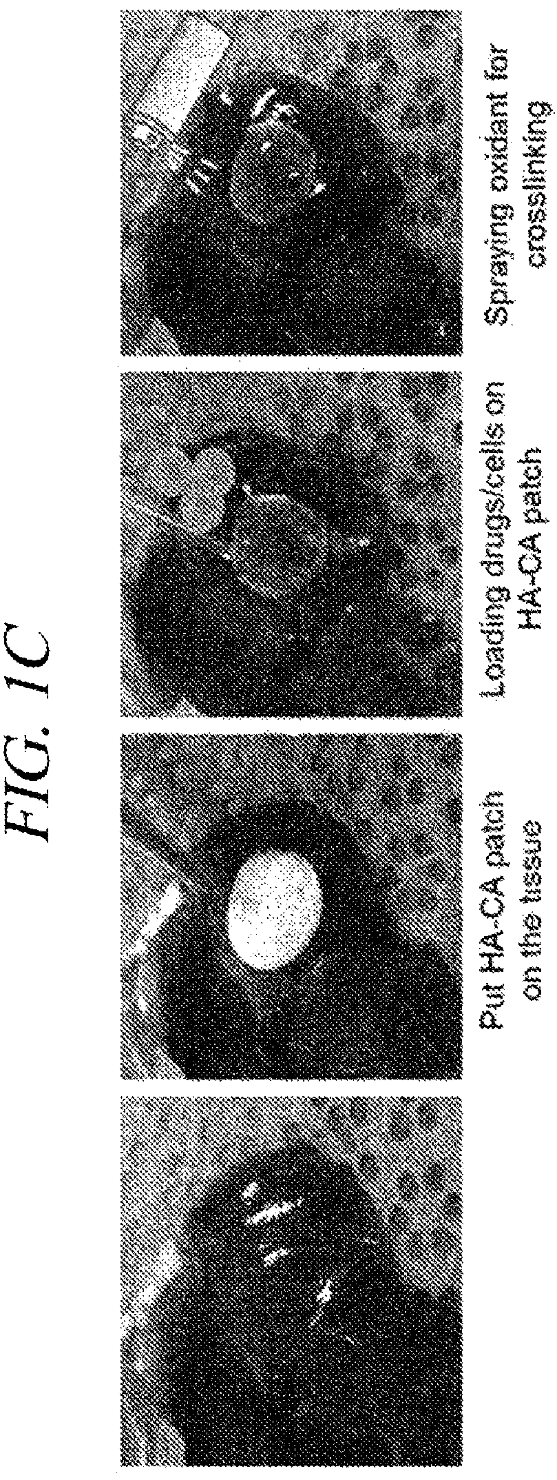 Patent US12569451 Figure 3 – Bio-inspired tissue-adhesive hydrogel patch and uses thereof