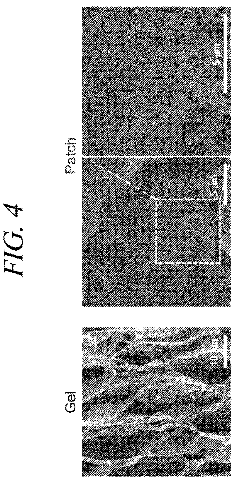 Patent US12569451 Figure 7 – Bio-inspired tissue-adhesive hydrogel patch and uses thereof