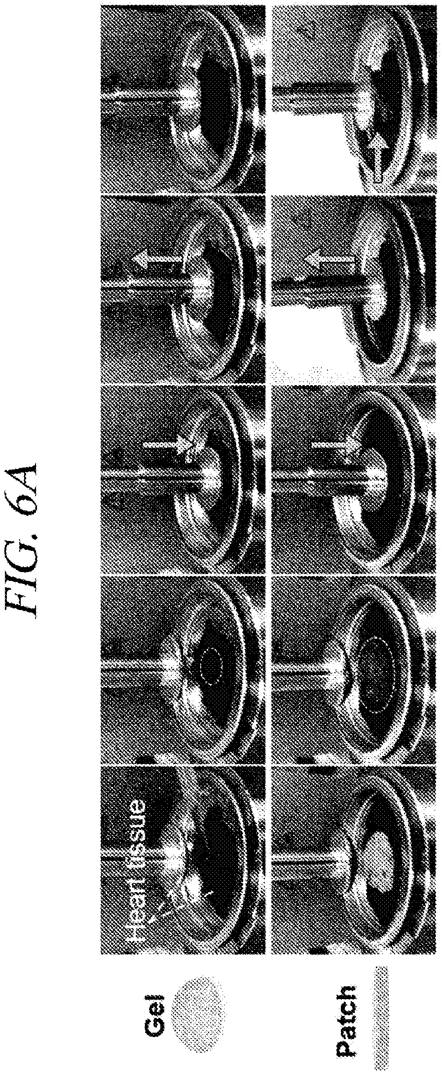 Patent US12569451 Figure 9 – Bio-inspired tissue-adhesive hydrogel patch and uses thereof