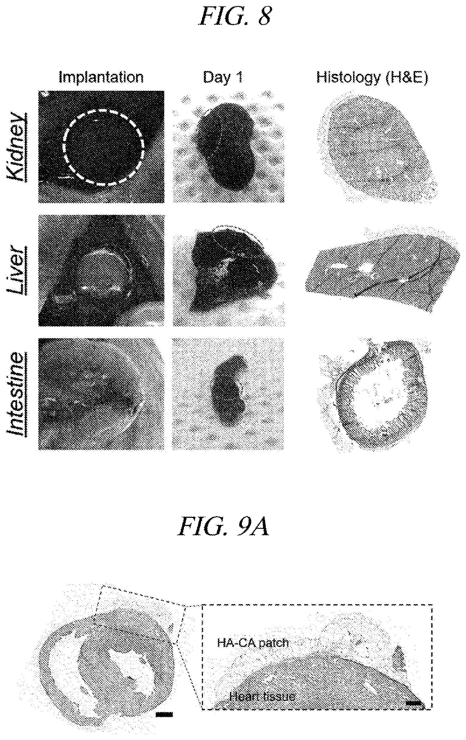 Patent US12569451 Figure 12 – Bio-inspired tissue-adhesive hydrogel patch and uses thereof
