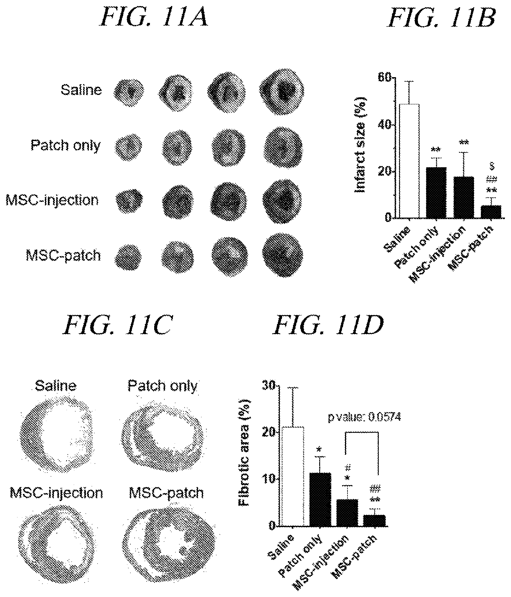 Patent US12569451 Figure 15 – Bio-inspired tissue-adhesive hydrogel patch and uses thereof