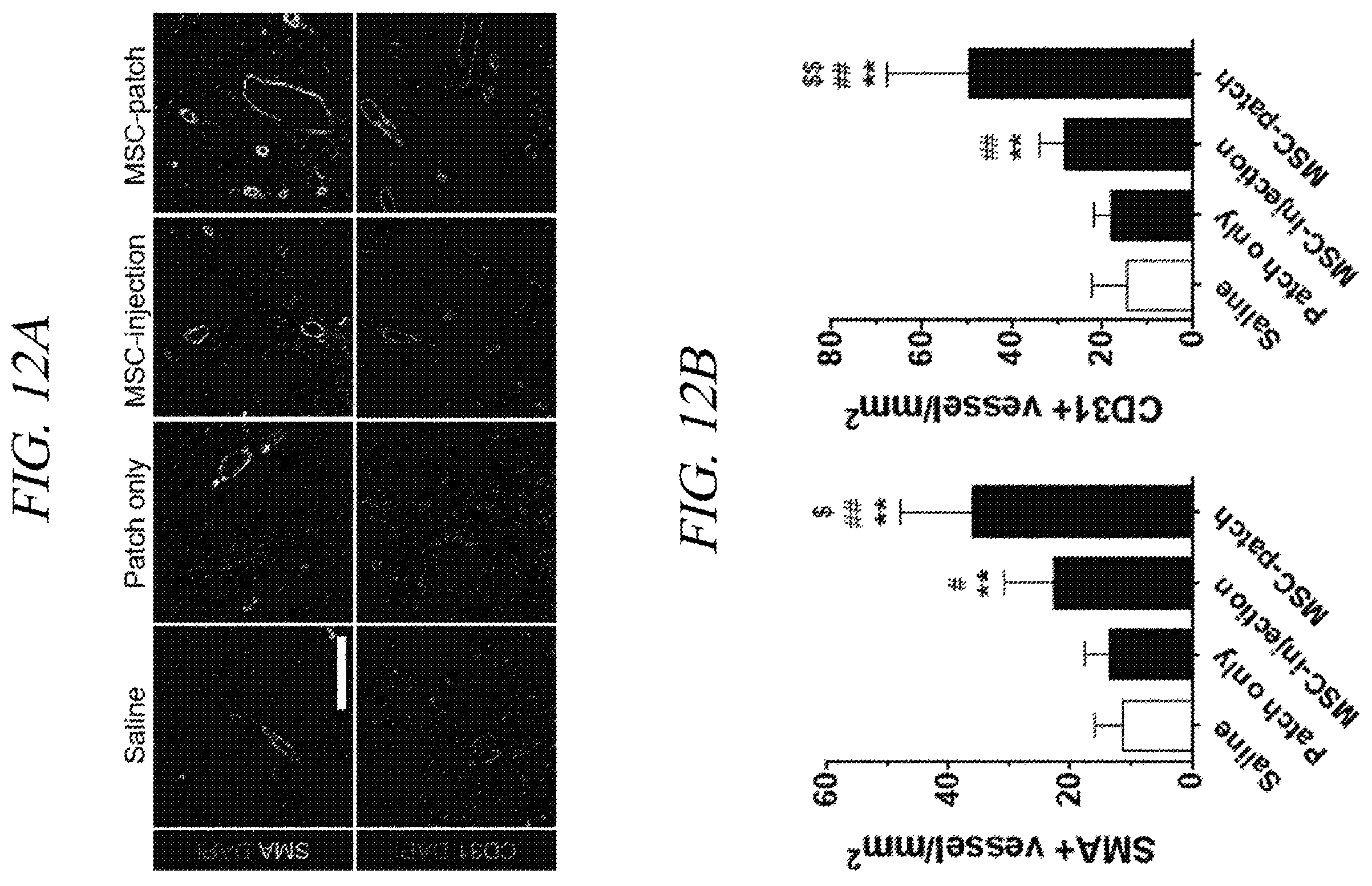 Patent US12569451 Figure 16 – Bio-inspired tissue-adhesive hydrogel patch and uses thereof