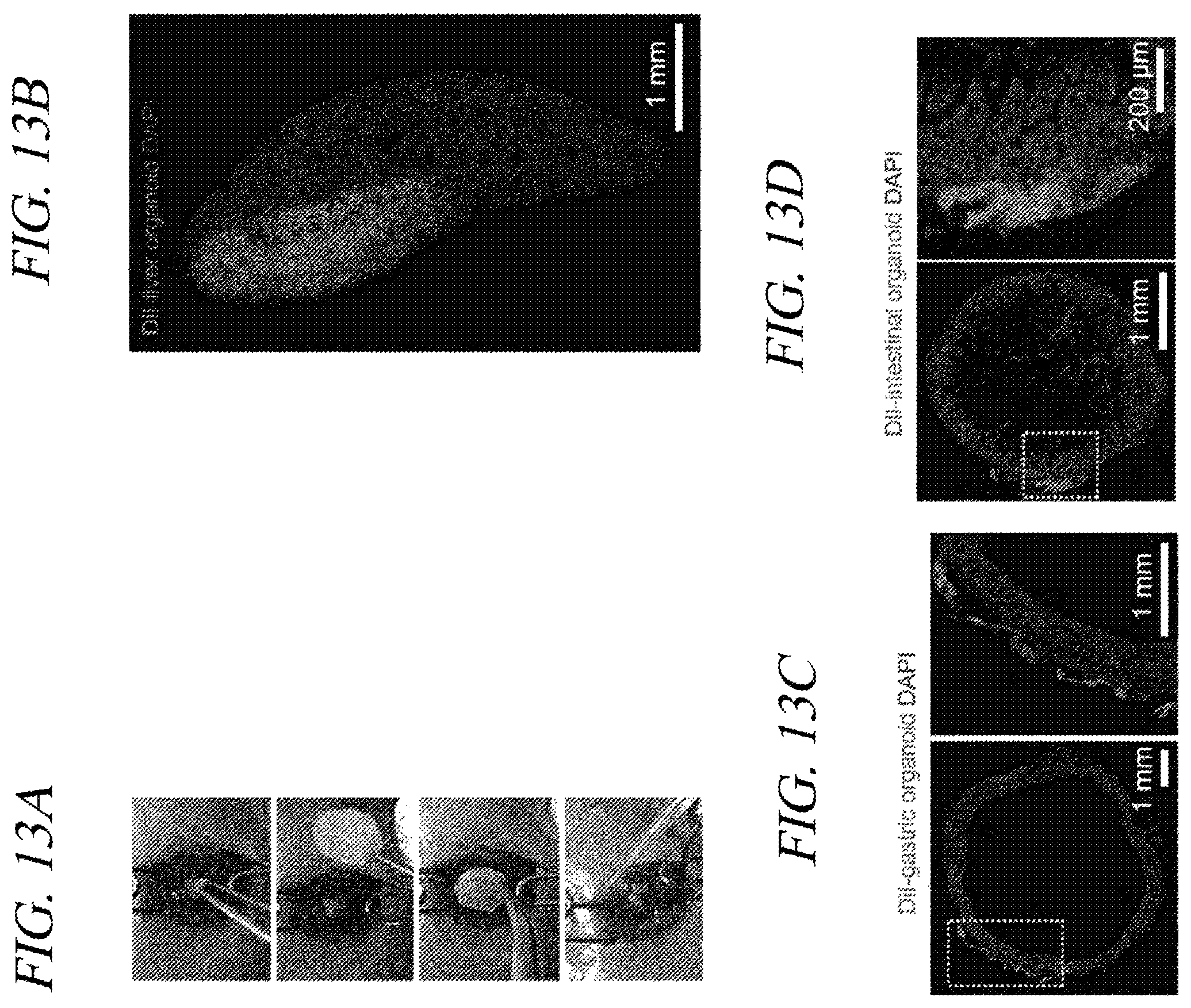 Patent US12569451 Figure 17 – Bio-inspired tissue-adhesive hydrogel patch and uses thereof