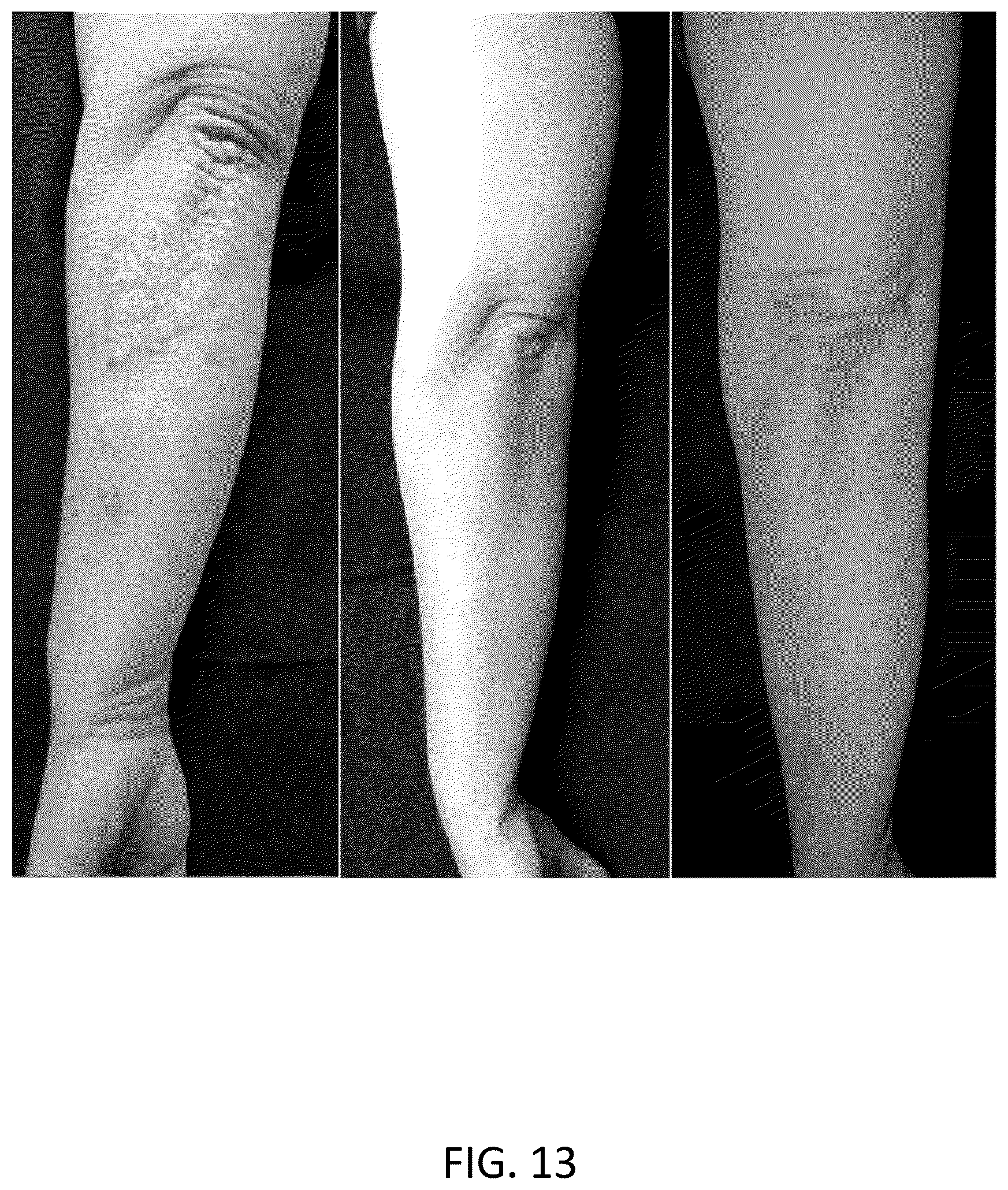Patent US12569453 Figure 14 – Use of tapinarof for the treatment of atopic dermatitis