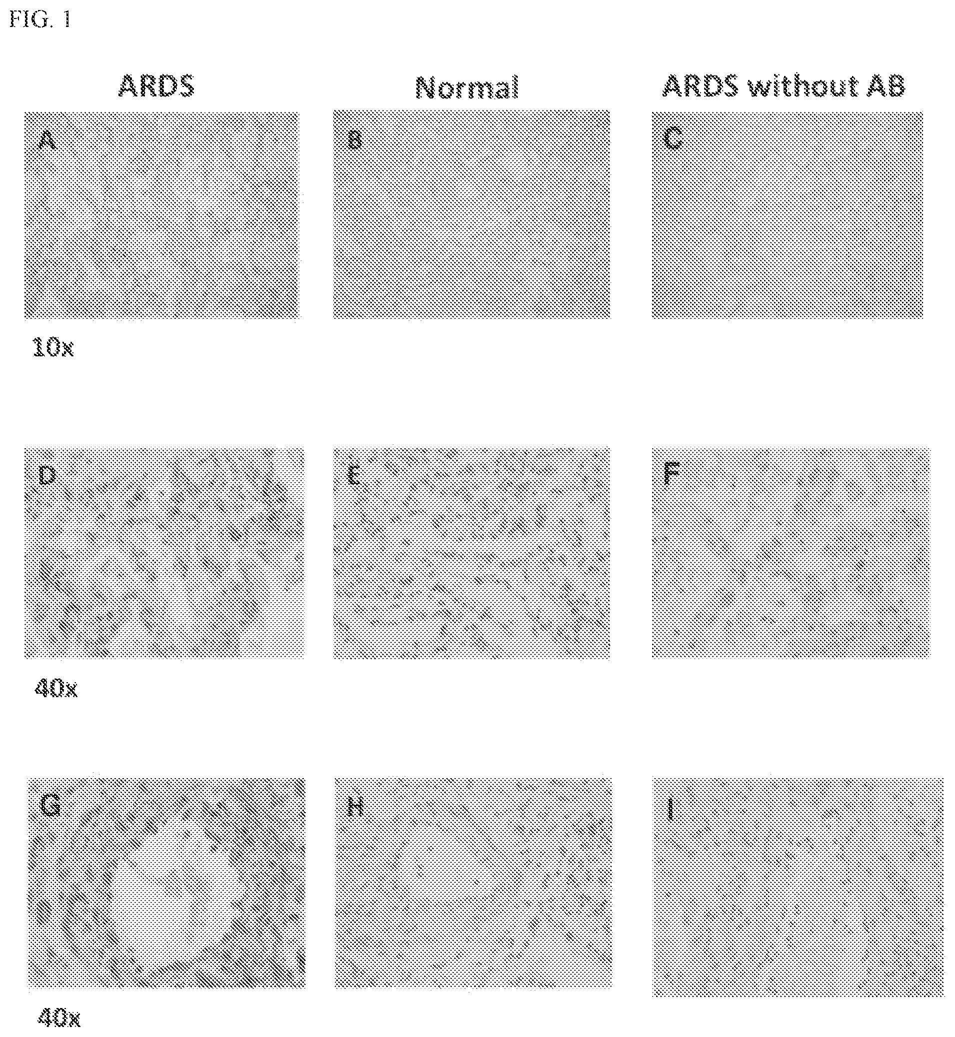 Patent US12569459 Figure 1 – Compositions and methods for treating pulmonary edema or lung inflammation