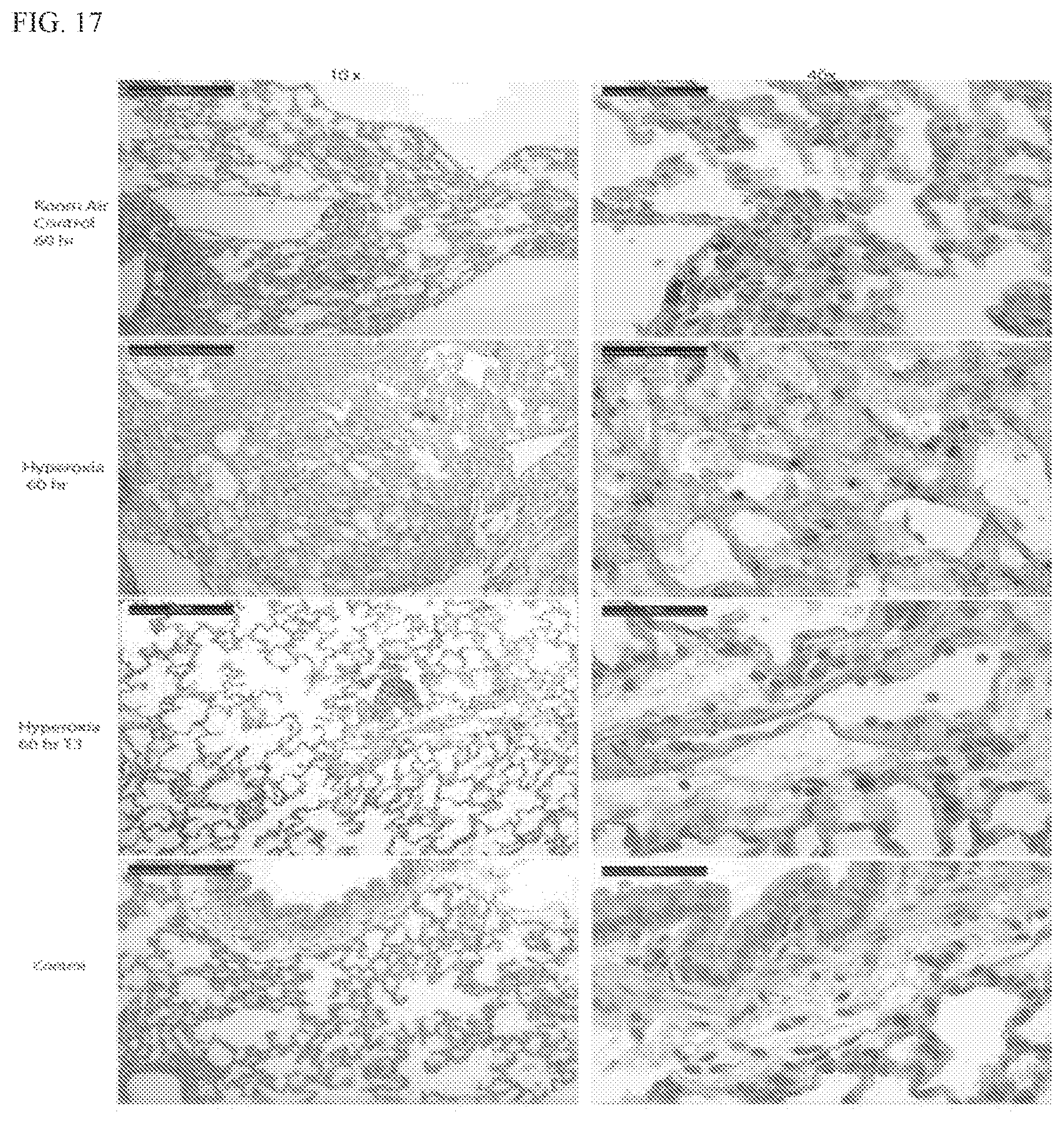 Patent US12569459 Figure 13 – Compositions and methods for treating pulmonary edema or lung inflammation