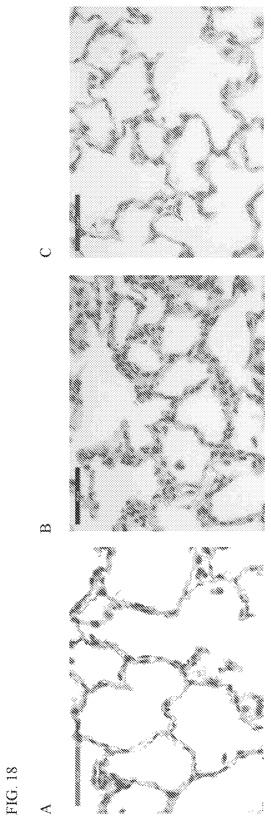 Patent US12569459 Figure 14 – Compositions and methods for treating pulmonary edema or lung inflammation