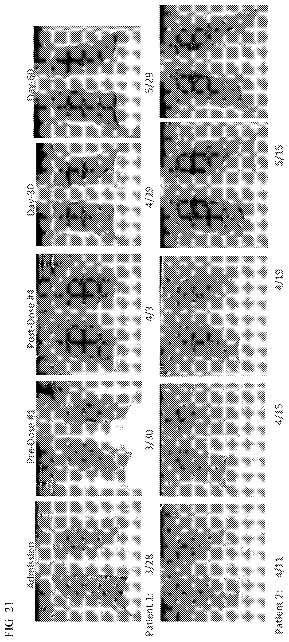 Patent US12569459 Figure 17 – Compositions and methods for treating pulmonary edema or lung inflammation