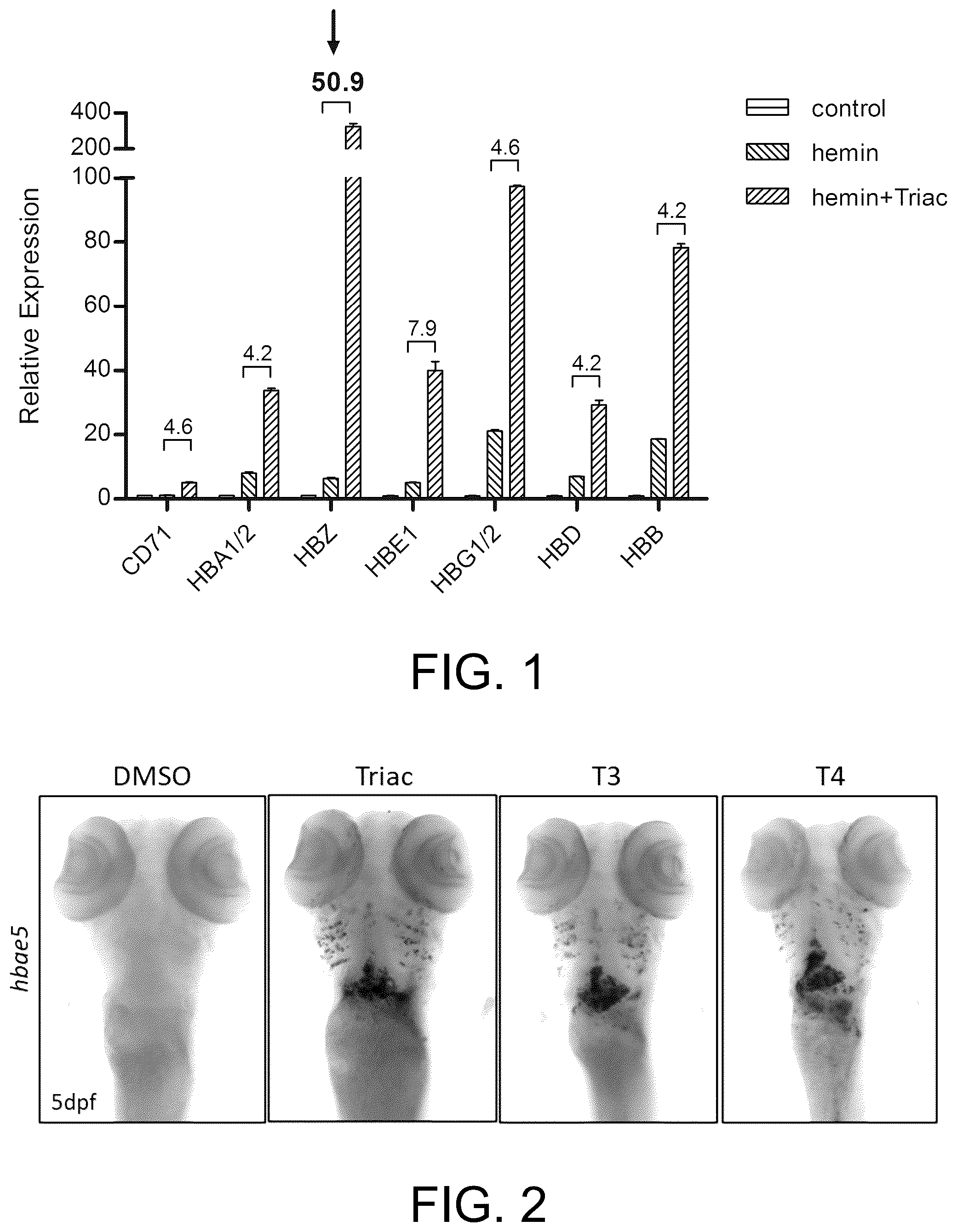 Patent US12569460 Figure 1 – Application of thyroid hormones and thyroid hormone analogues to preparation of drugs for treating sickle-cell disease