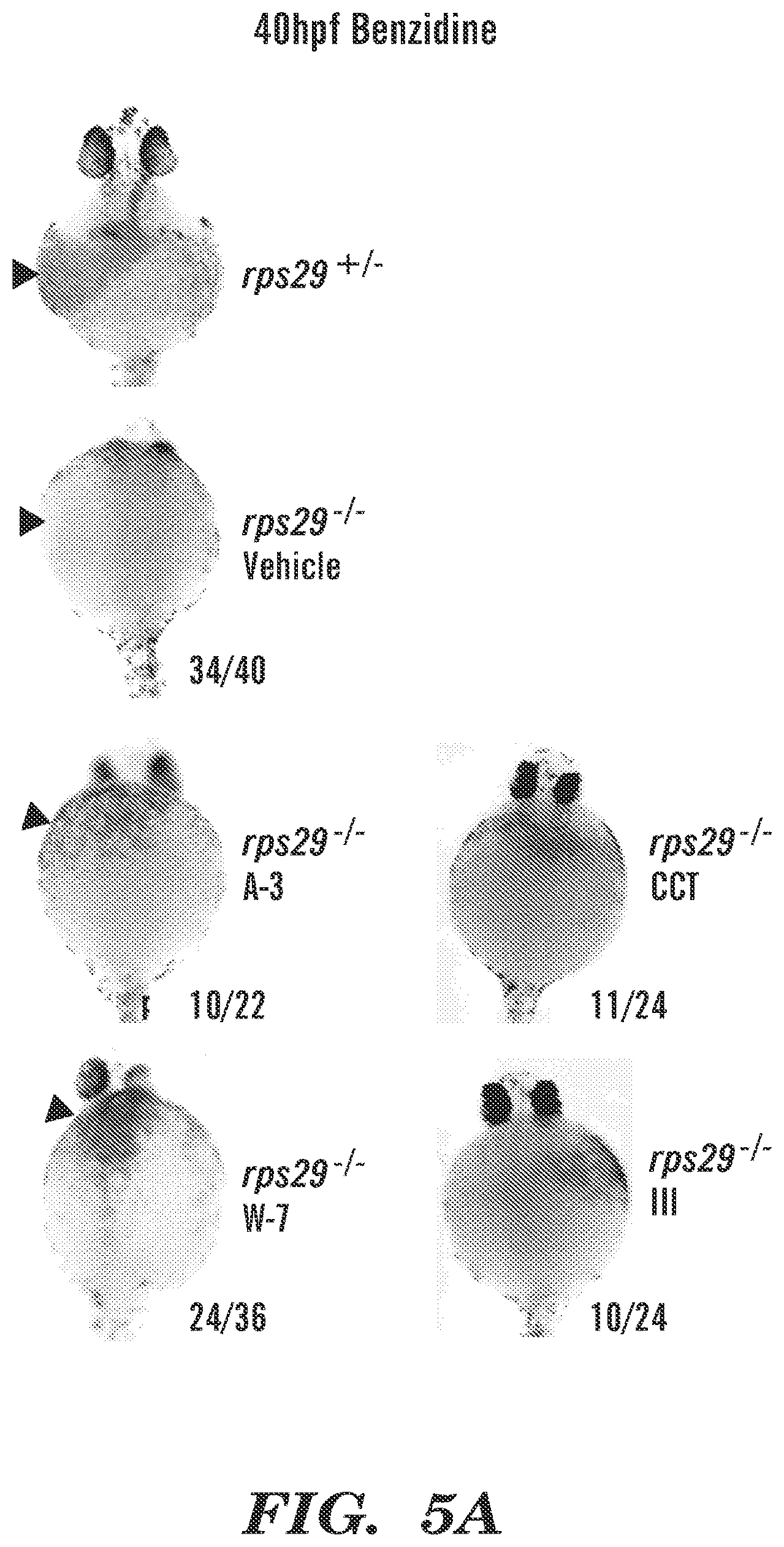 Patent US12569486 Figure 5 – Calmodulin inhibitors, CHK2 inhibitors and RSK inhibitors for the treatment of ribosomal disorders and ribosomapathies