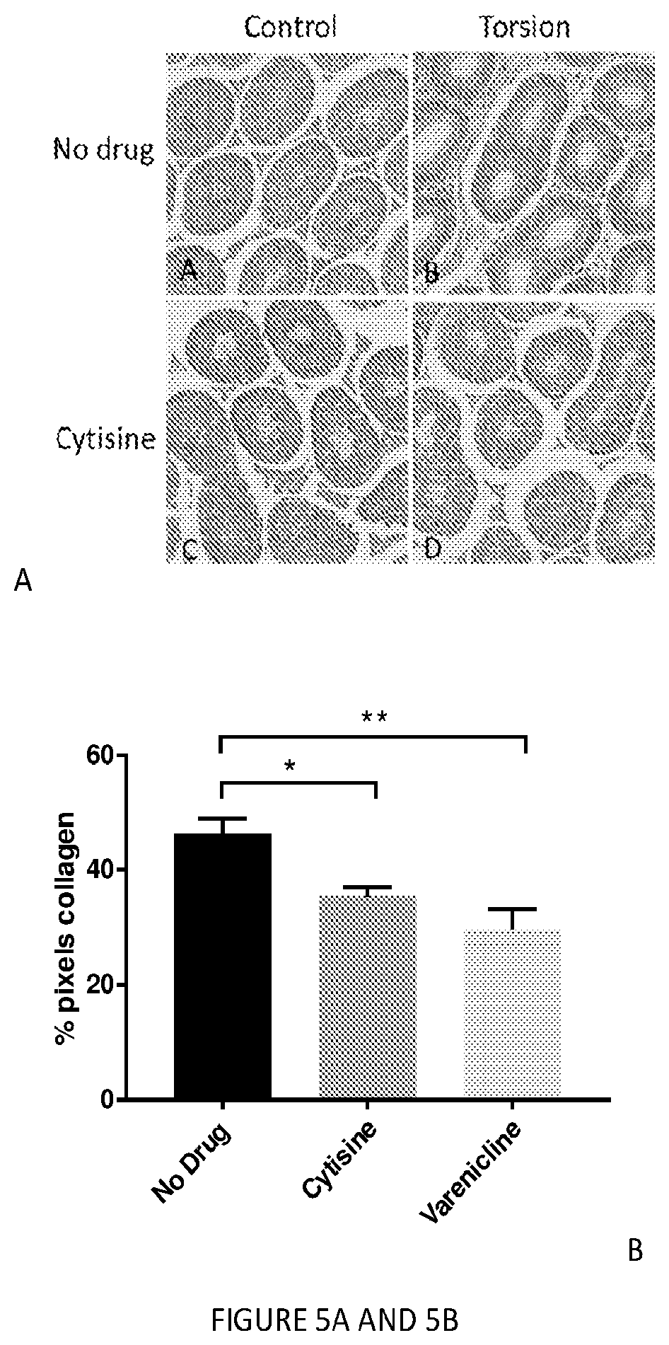 Patent US12569498 Figure 5 – Methods and compositions for the prevention and treatment of ischemia reperfusion injury and infection