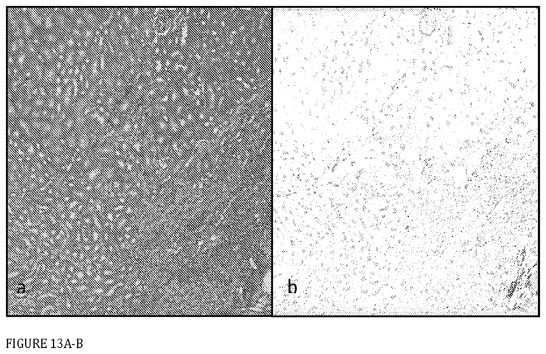Patent US12569498 Figure 13 – Methods and compositions for the prevention and treatment of ischemia reperfusion injury and infection