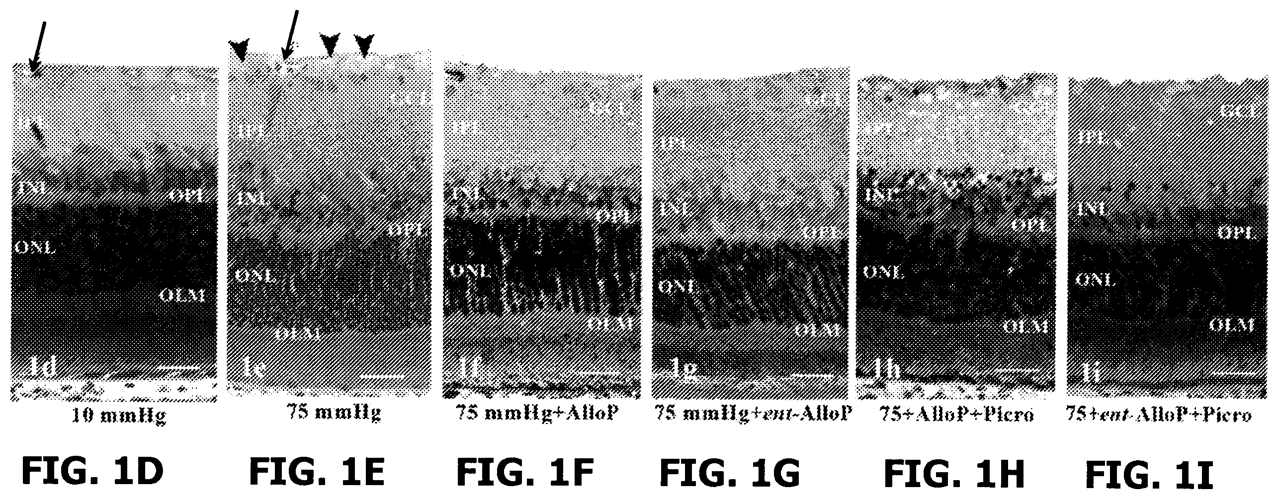 Patent US12569501 Figure 3 – Neurosteroids and enantiomers thereof for the prevention and treatment of neurodegenerative conditions