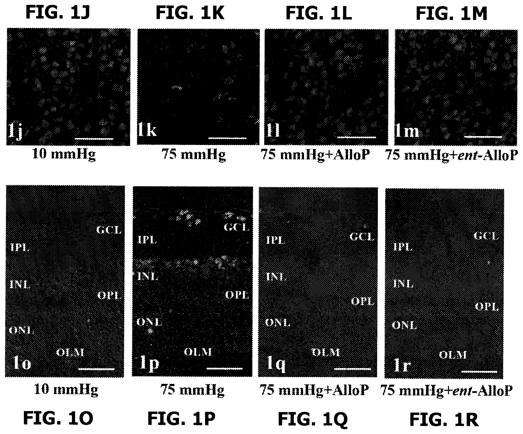 Patent US12569501 Figure 4 – Neurosteroids and enantiomers thereof for the prevention and treatment of neurodegenerative conditions