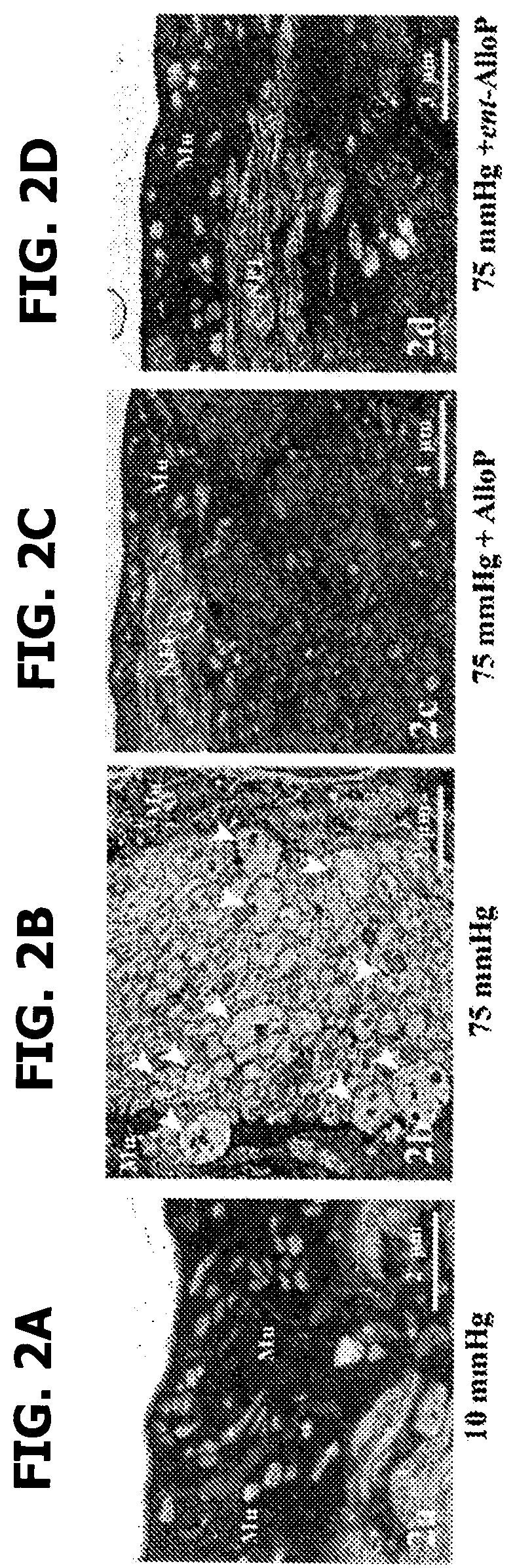 Patent US12569501 Figure 6 – Neurosteroids and enantiomers thereof for the prevention and treatment of neurodegenerative conditions