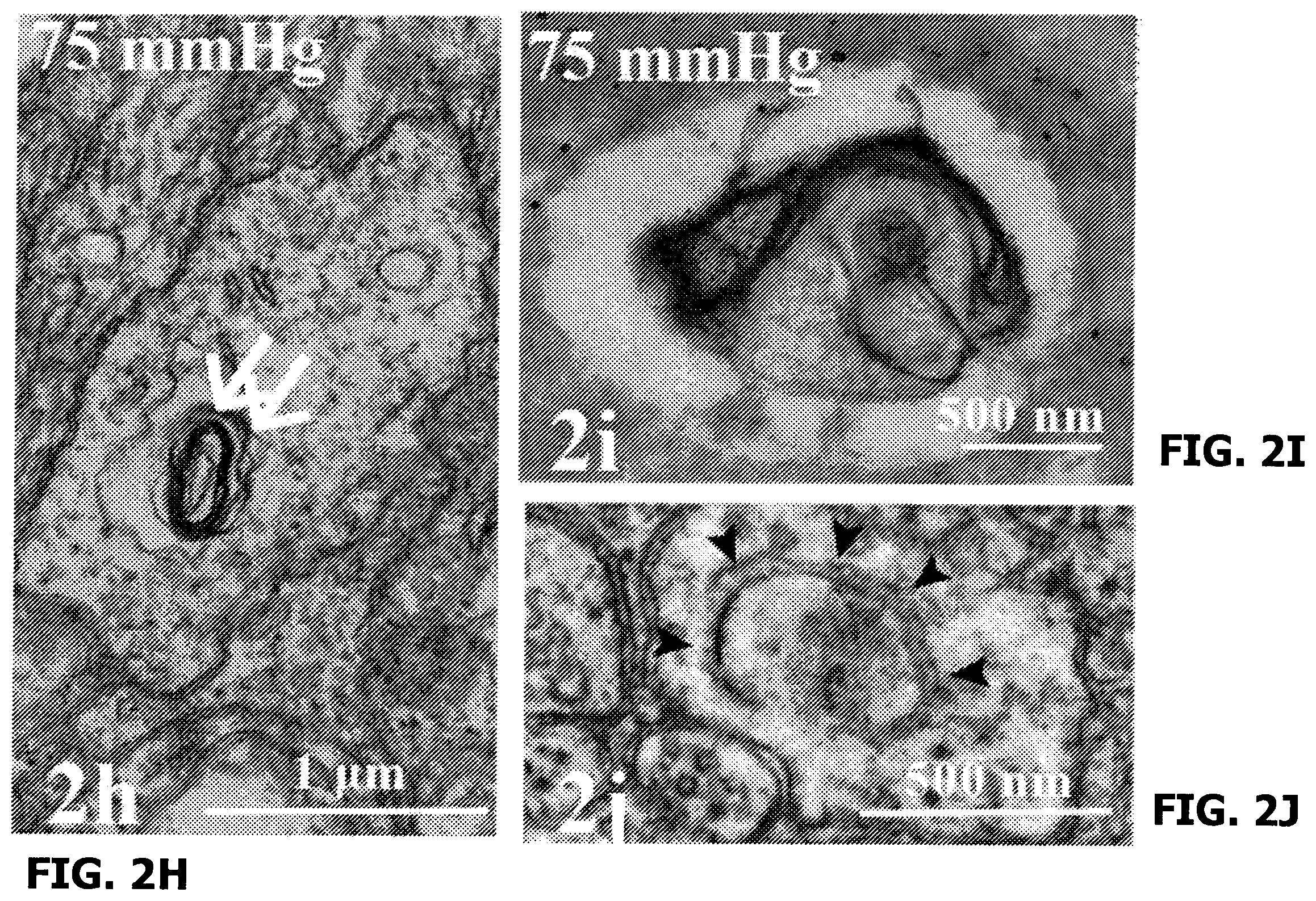 Patent US12569501 Figure 8 – Neurosteroids and enantiomers thereof for the prevention and treatment of neurodegenerative conditions