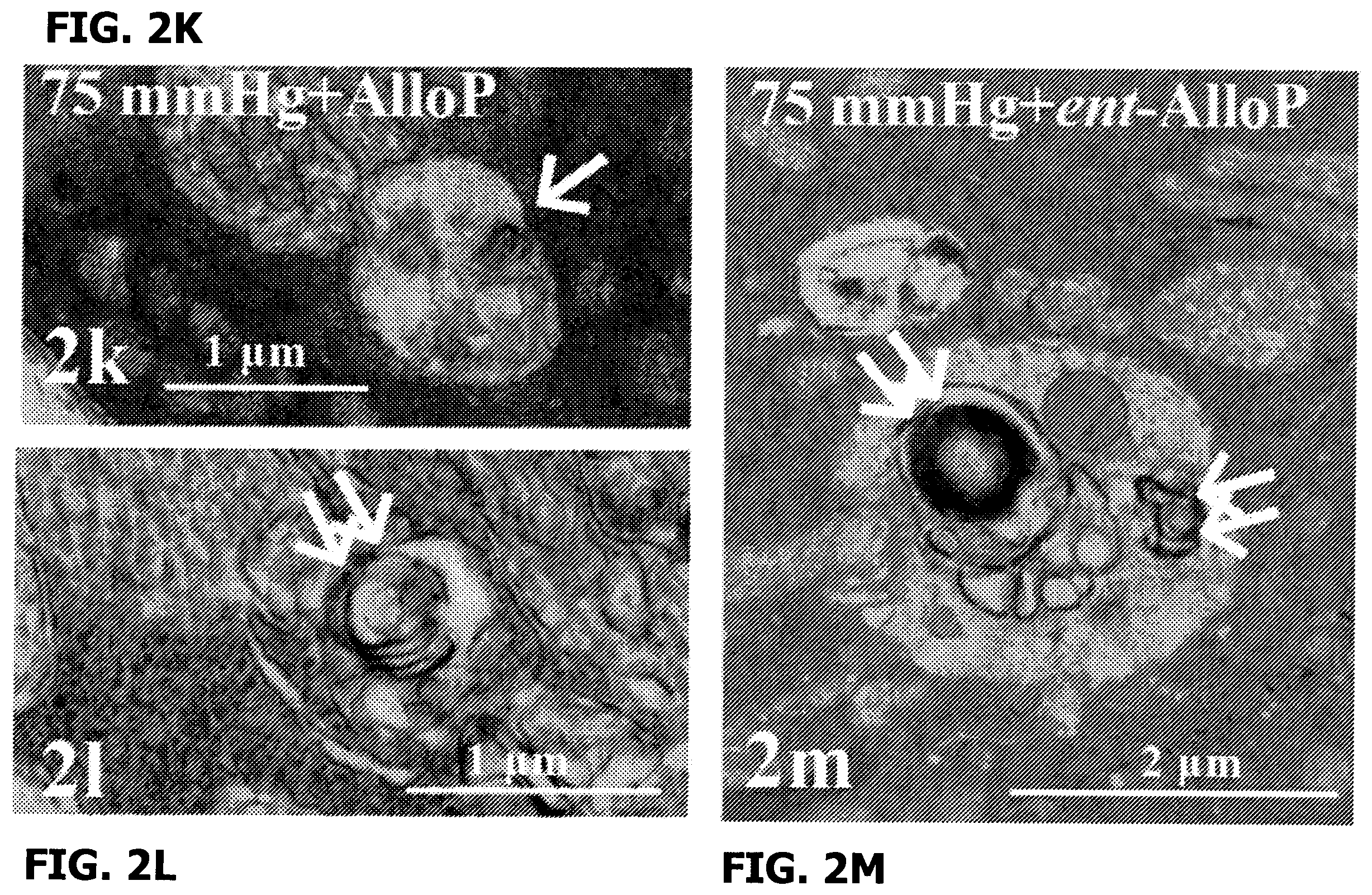 Patent US12569501 Figure 9 – Neurosteroids and enantiomers thereof for the prevention and treatment of neurodegenerative conditions