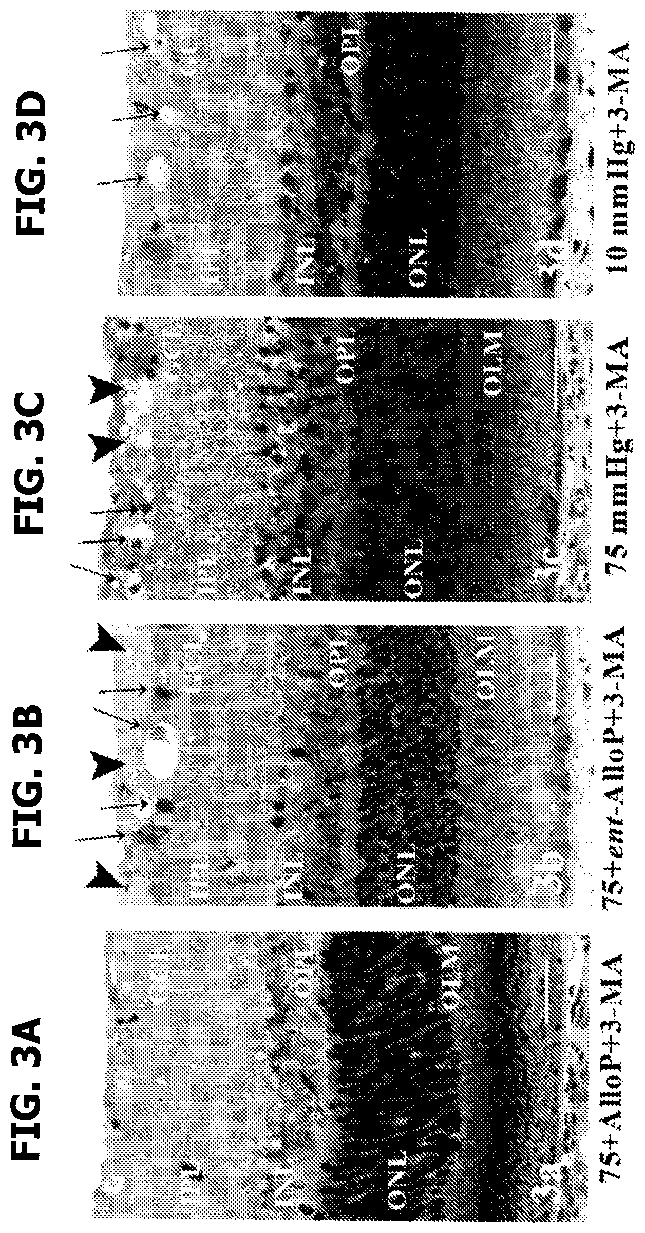 Patent US12569501 Figure 12 – Neurosteroids and enantiomers thereof for the prevention and treatment of neurodegenerative conditions