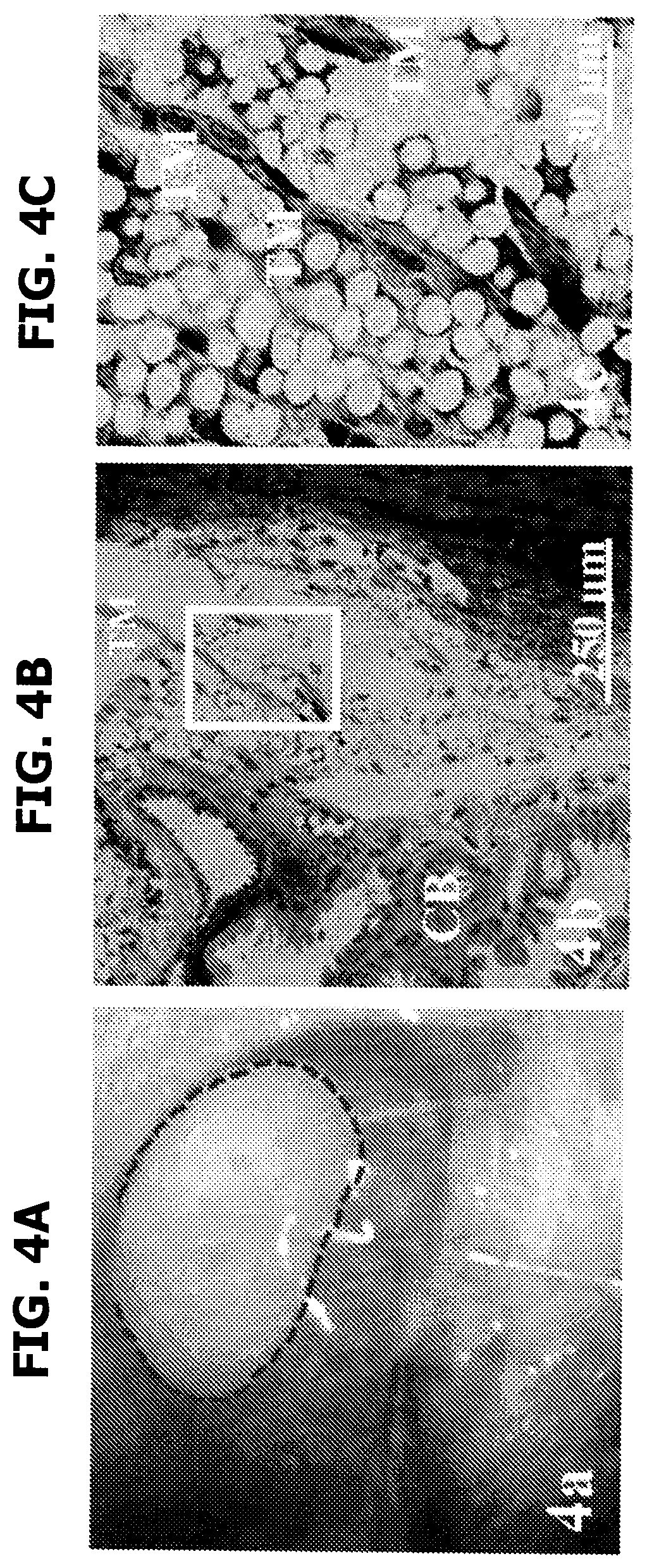 Patent US12569501 Figure 14 – Neurosteroids and enantiomers thereof for the prevention and treatment of neurodegenerative conditions