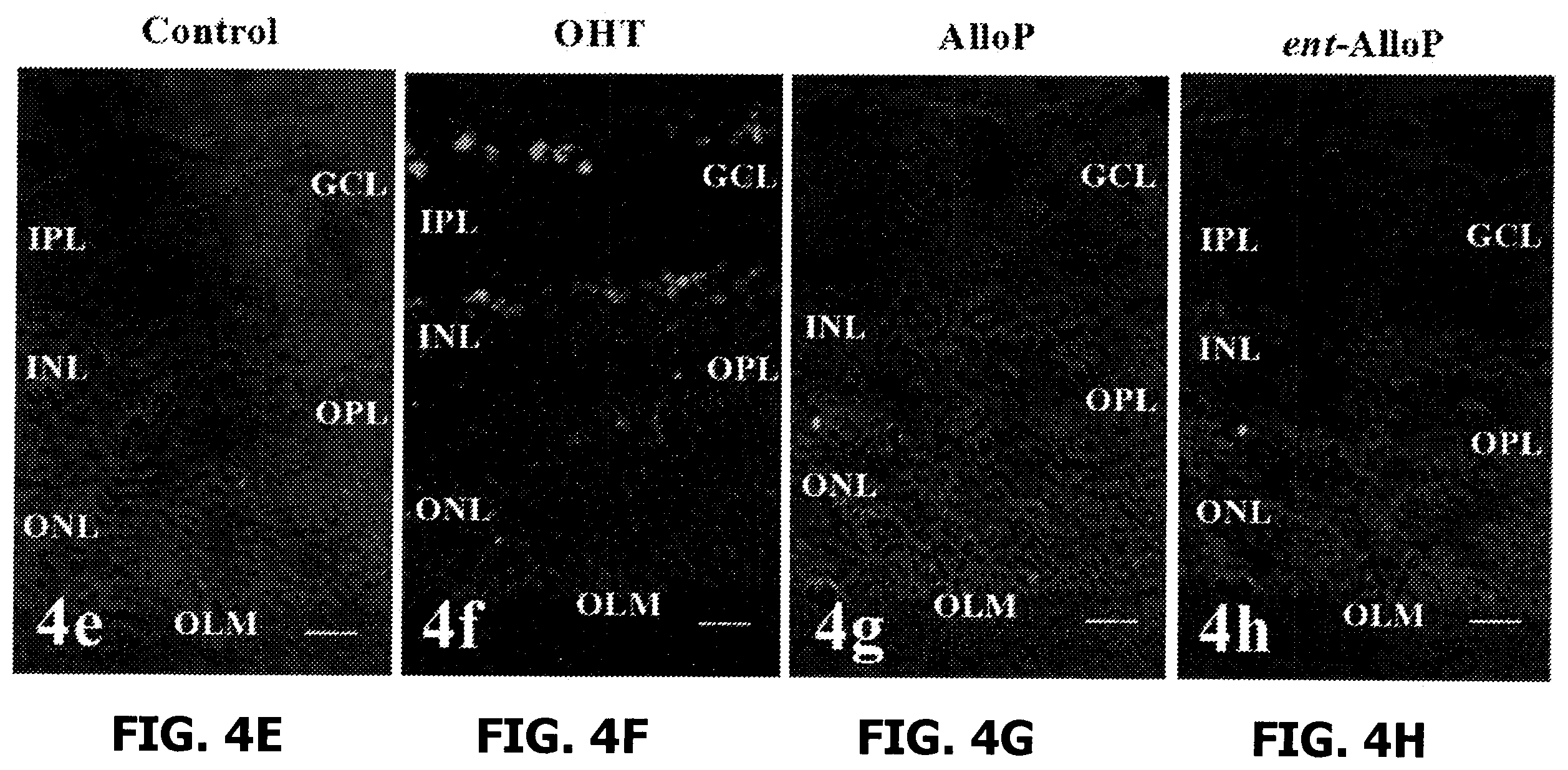 Patent US12569501 Figure 16 – Neurosteroids and enantiomers thereof for the prevention and treatment of neurodegenerative conditions