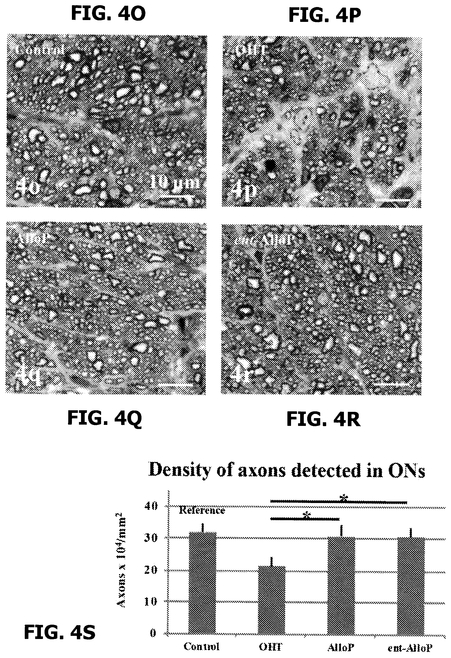 Patent US12569501 Figure 18 – Neurosteroids and enantiomers thereof for the prevention and treatment of neurodegenerative conditions