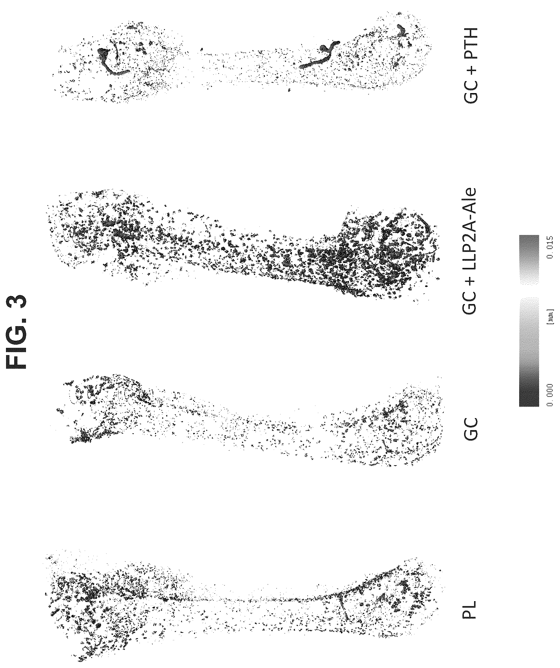 Patent US12569506 Figure 3 – Methods of treating osteonecrosis with LLP2A-bisphosphonate compounds