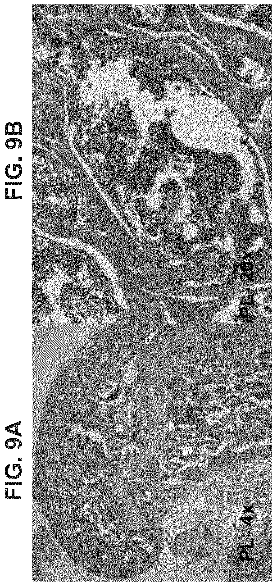 Patent US12569506 Figure 10 – Methods of treating osteonecrosis with LLP2A-bisphosphonate compounds