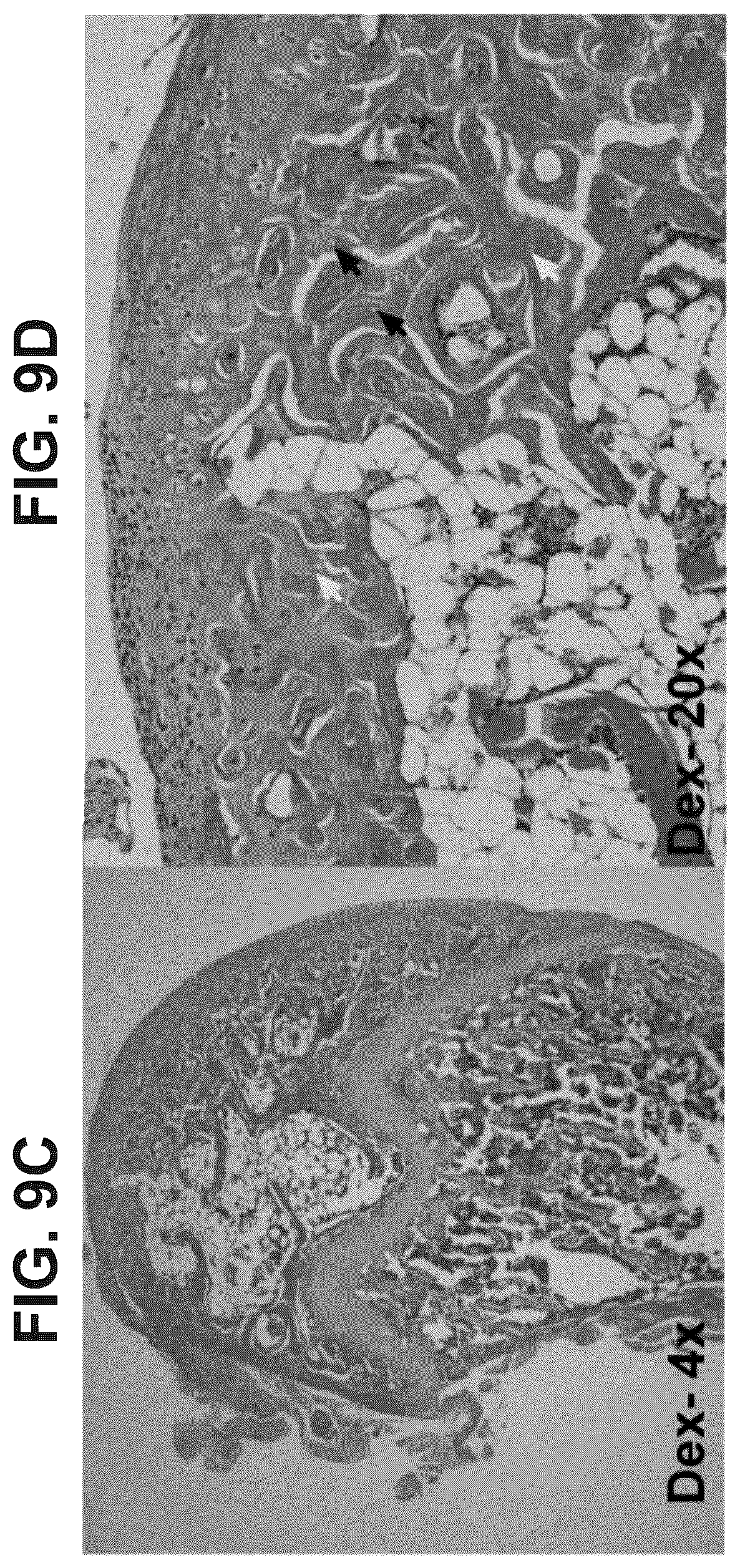 Patent US12569506 Figure 11 – Methods of treating osteonecrosis with LLP2A-bisphosphonate compounds