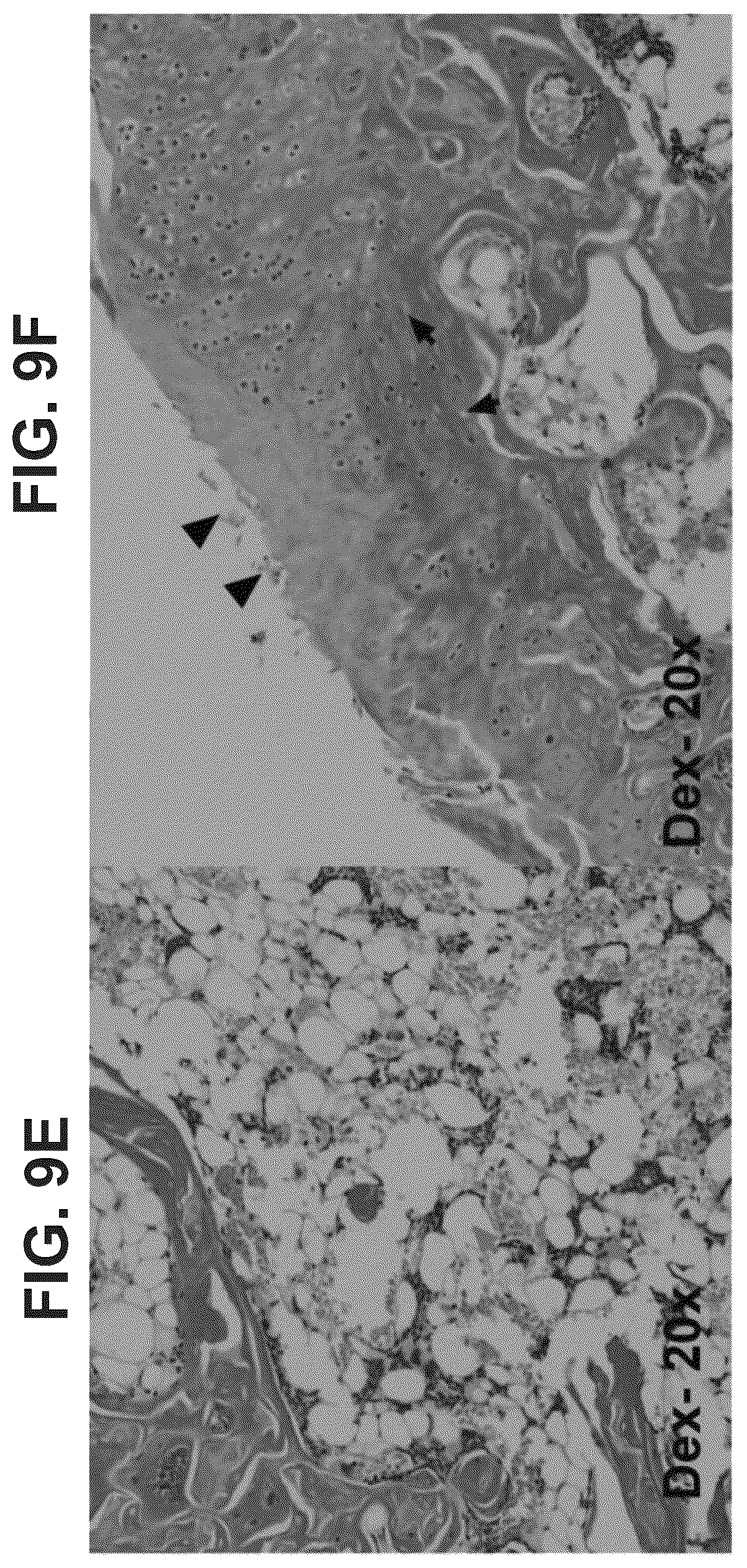 Patent US12569506 Figure 12 – Methods of treating osteonecrosis with LLP2A-bisphosphonate compounds