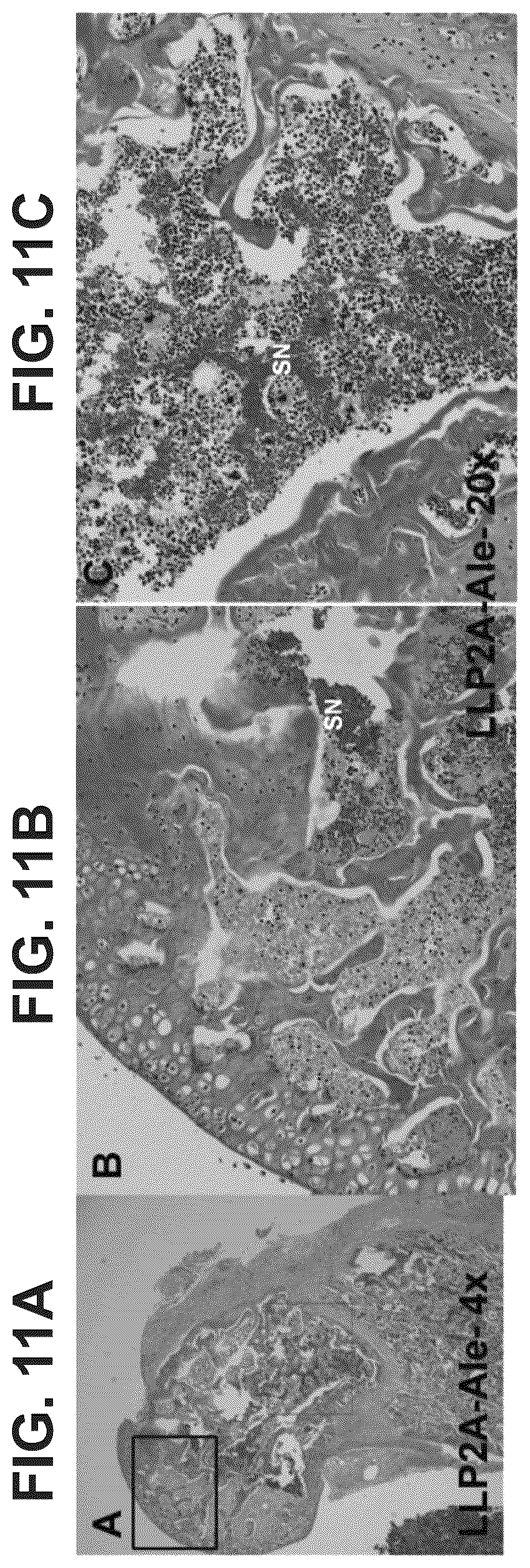Patent US12569506 Figure 15 – Methods of treating osteonecrosis with LLP2A-bisphosphonate compounds