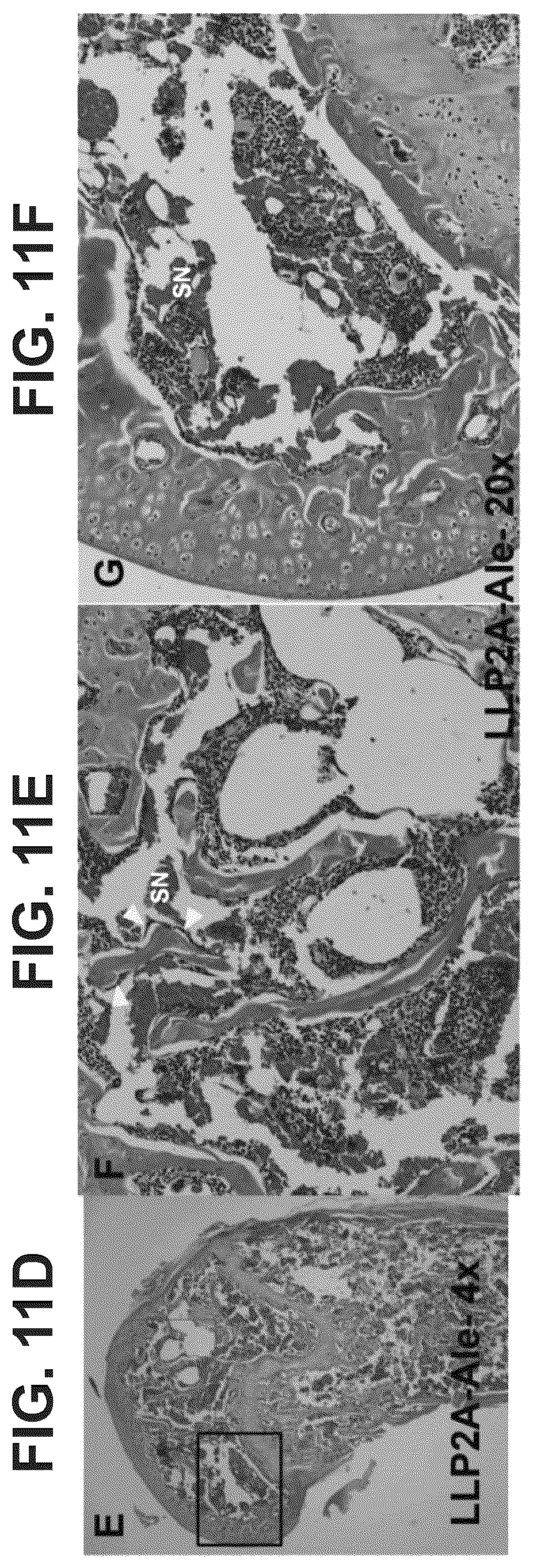 Patent US12569506 Figure 16 – Methods of treating osteonecrosis with LLP2A-bisphosphonate compounds