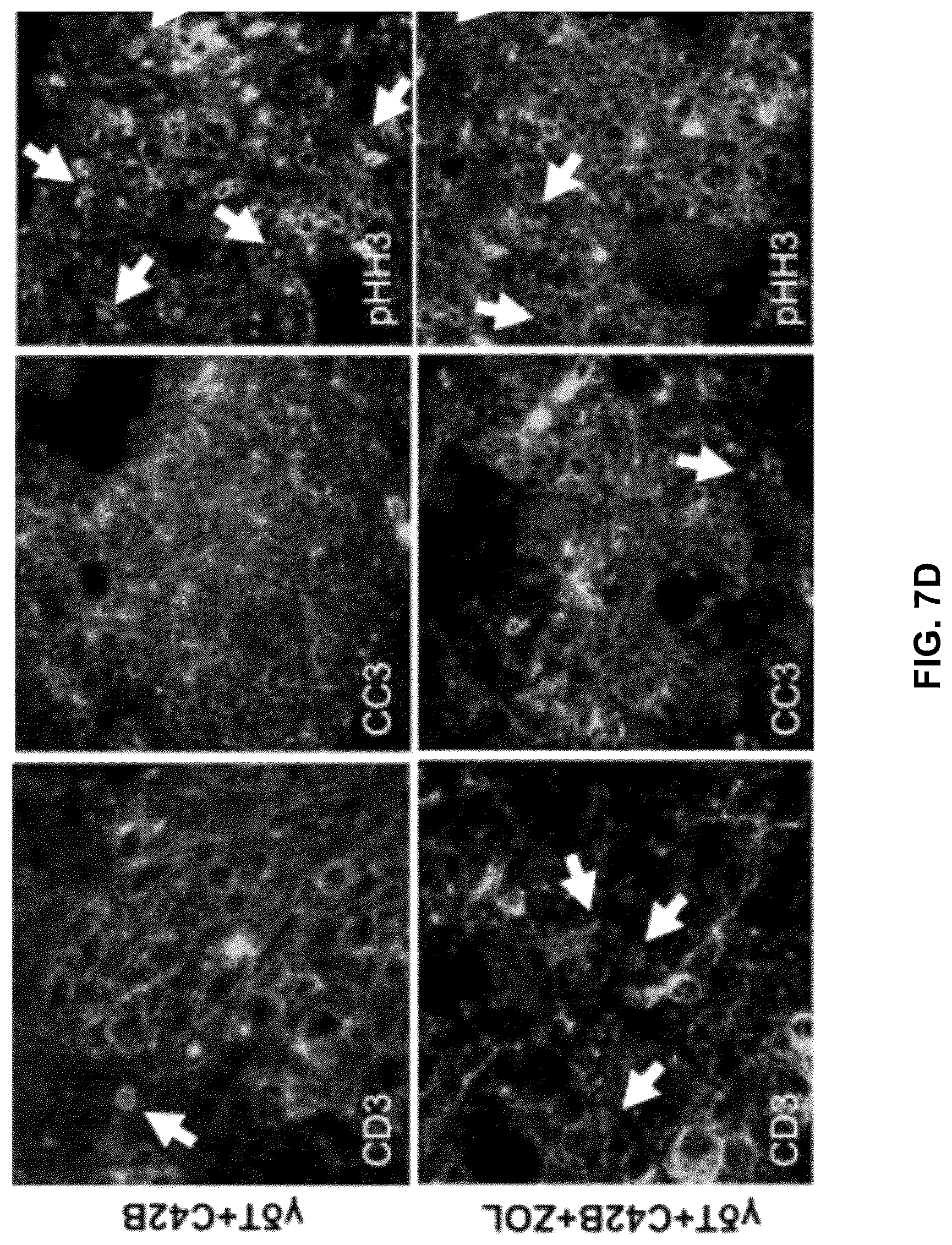 Patent US12569507 Figure 16 – CAR T-cells for the treatment of bone metastatic cancer