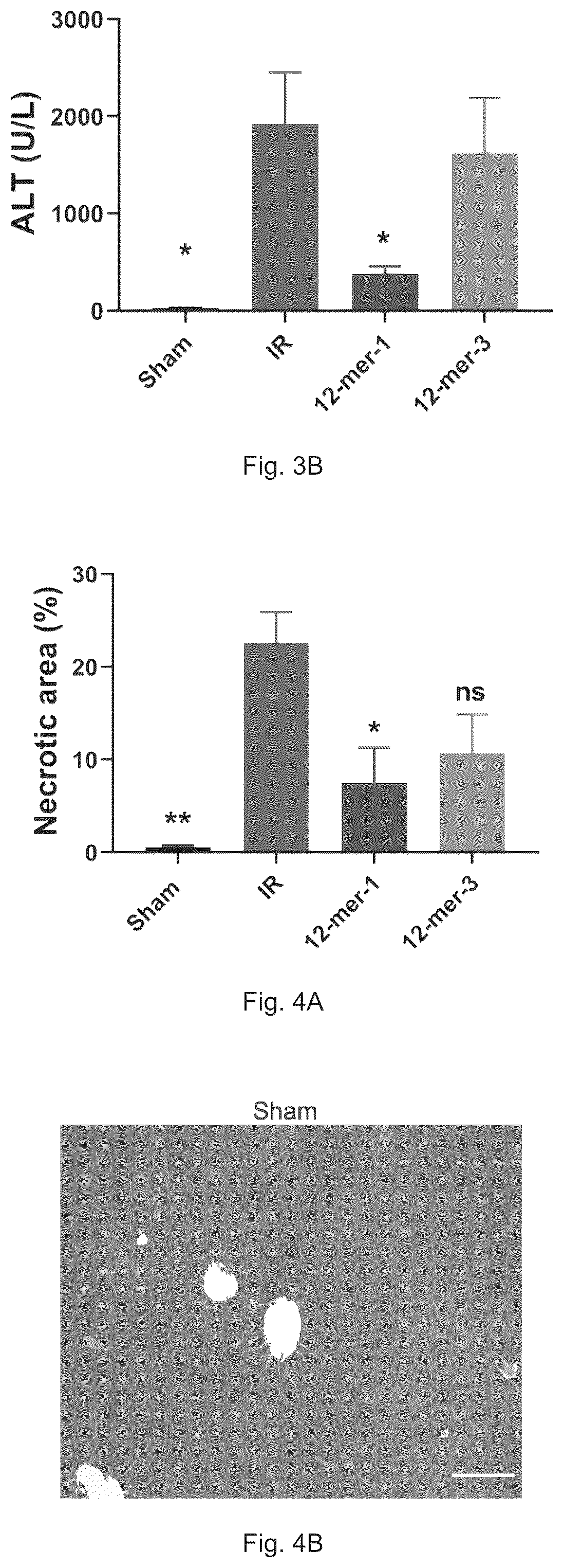 Patent US12569512 Figure 5 – Heparan sulfate (HS) oligosaccharides effect in liver ischemia reperfusion injury