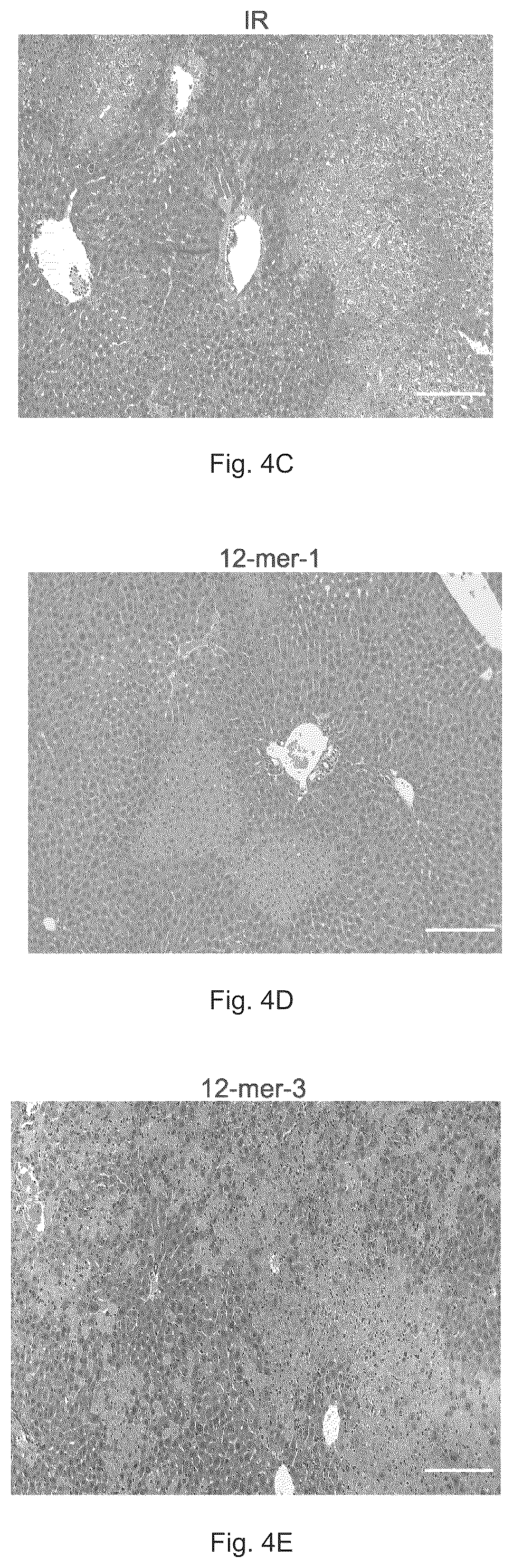 Patent US12569512 Figure 6 – Heparan sulfate (HS) oligosaccharides effect in liver ischemia reperfusion injury