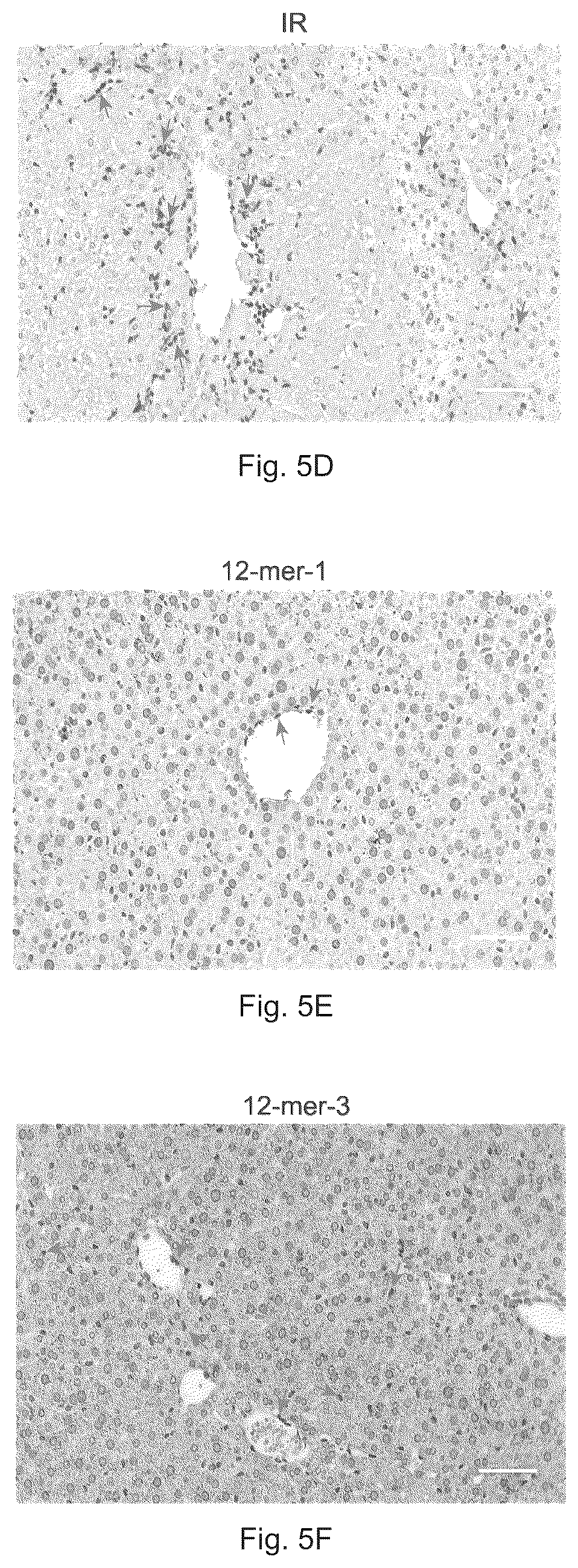 Patent US12569512 Figure 8 – Heparan sulfate (HS) oligosaccharides effect in liver ischemia reperfusion injury
