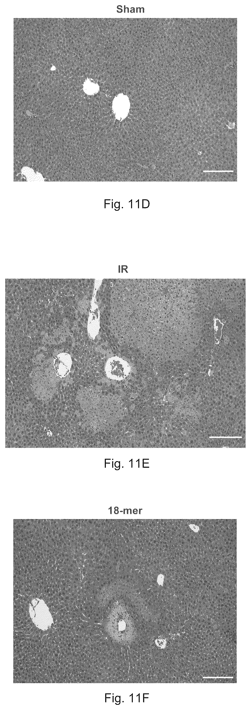 Patent US12569512 Figure 15 – Heparan sulfate (HS) oligosaccharides effect in liver ischemia reperfusion injury