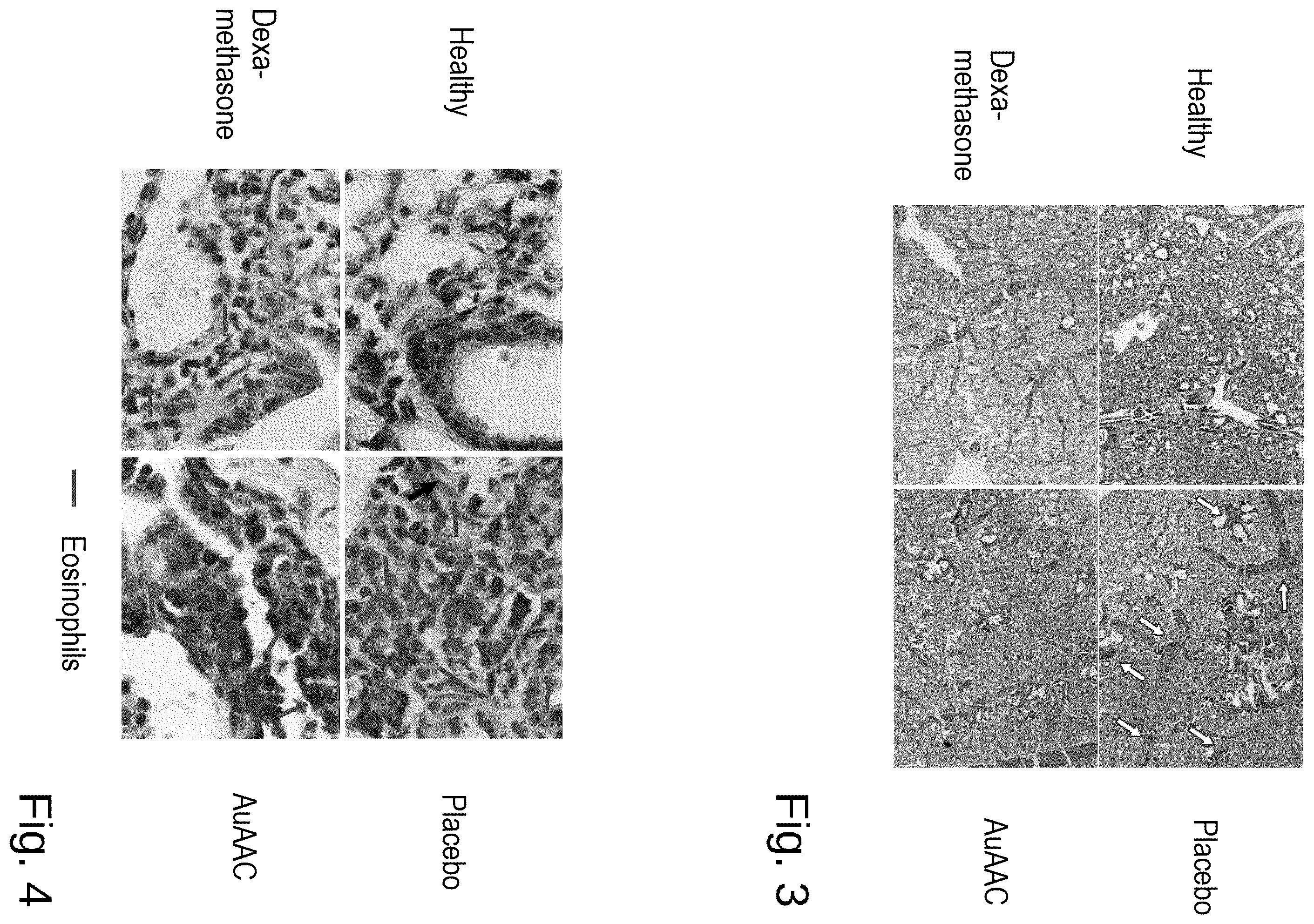 Patent US12569515 Figure 2 – Gold-containing agents for the treatment of lung infections