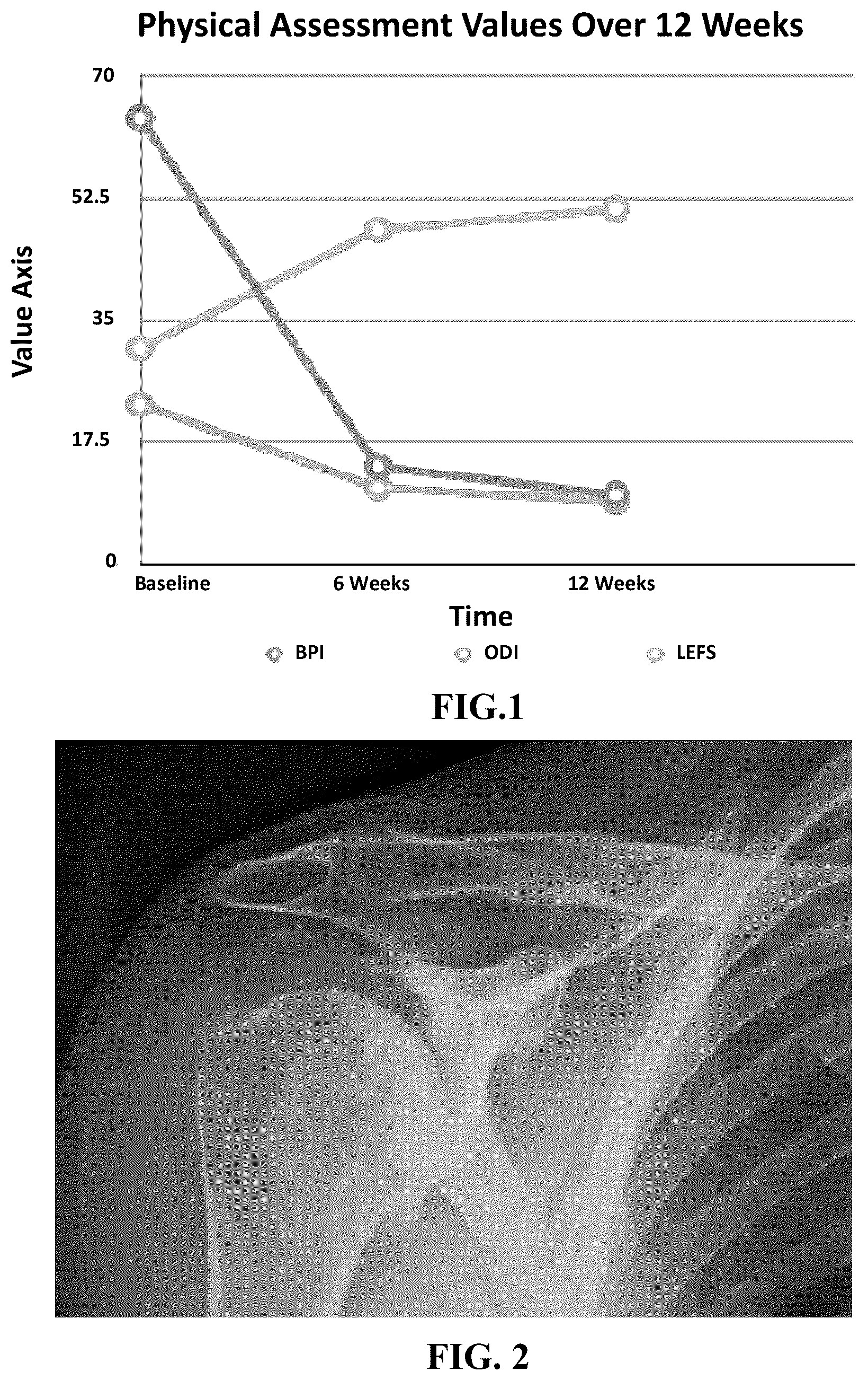 Patent US12569517 Figure 1 – Method for treating osteoarthritis with mesenchymal stem cell exosomes