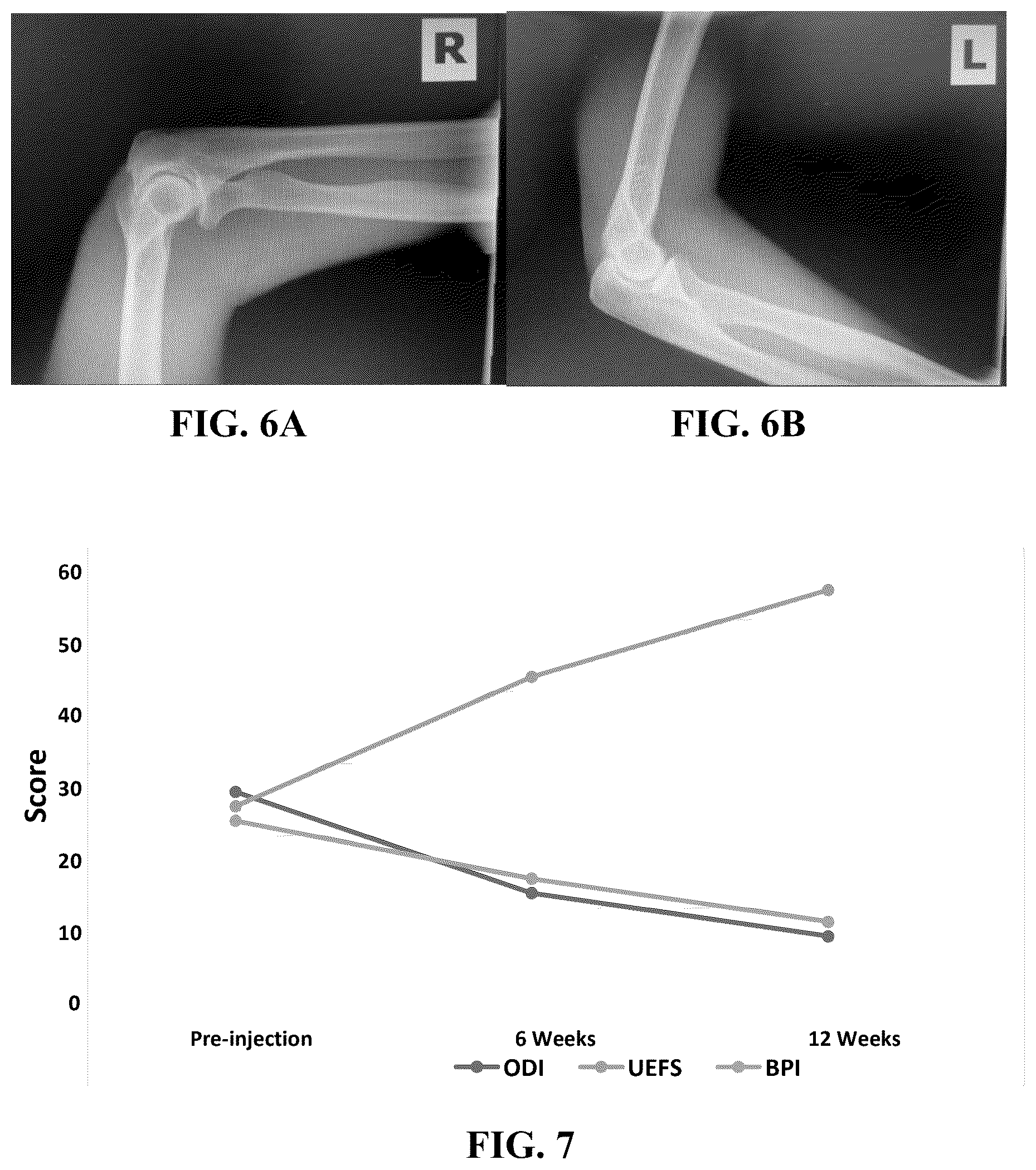 Patent US12569517 Figure 5 – Method for treating osteoarthritis with mesenchymal stem cell exosomes