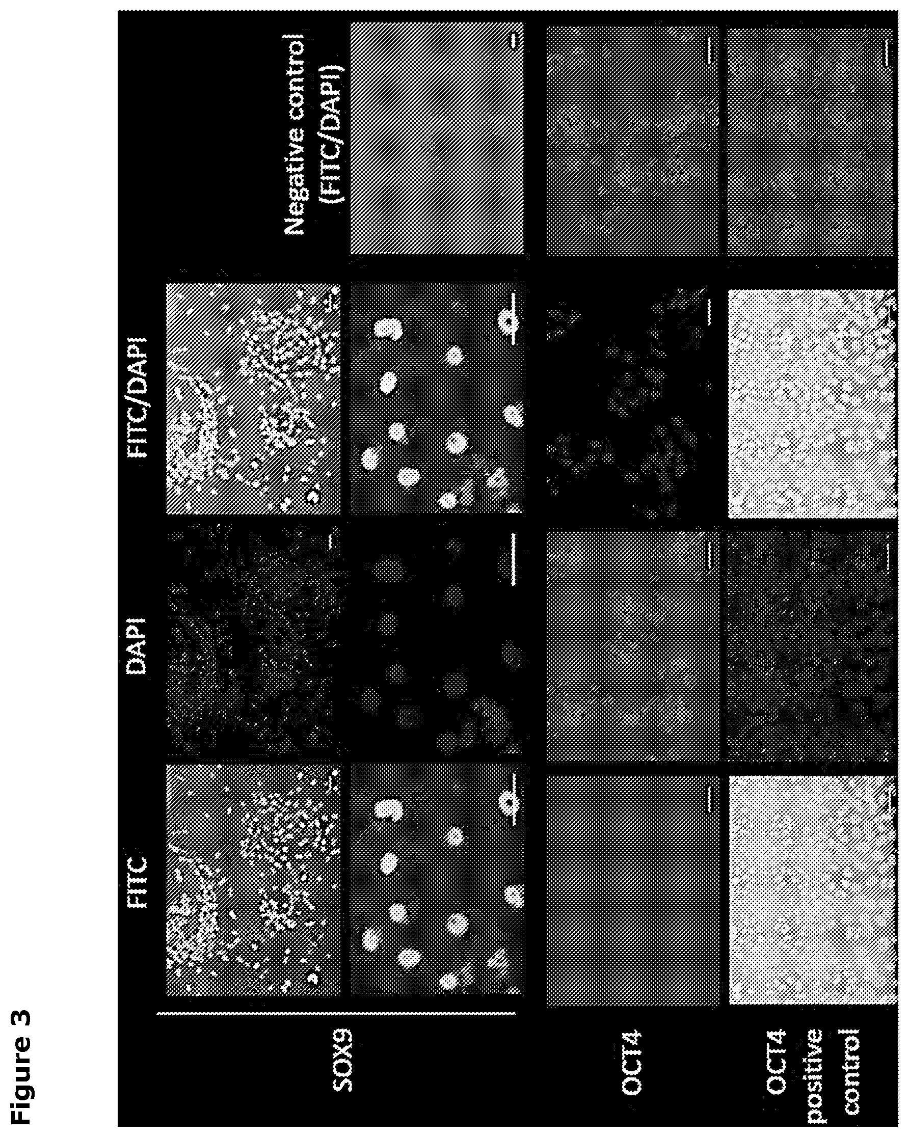 Patent US12569518 Figure 3 – Cartilage tissue