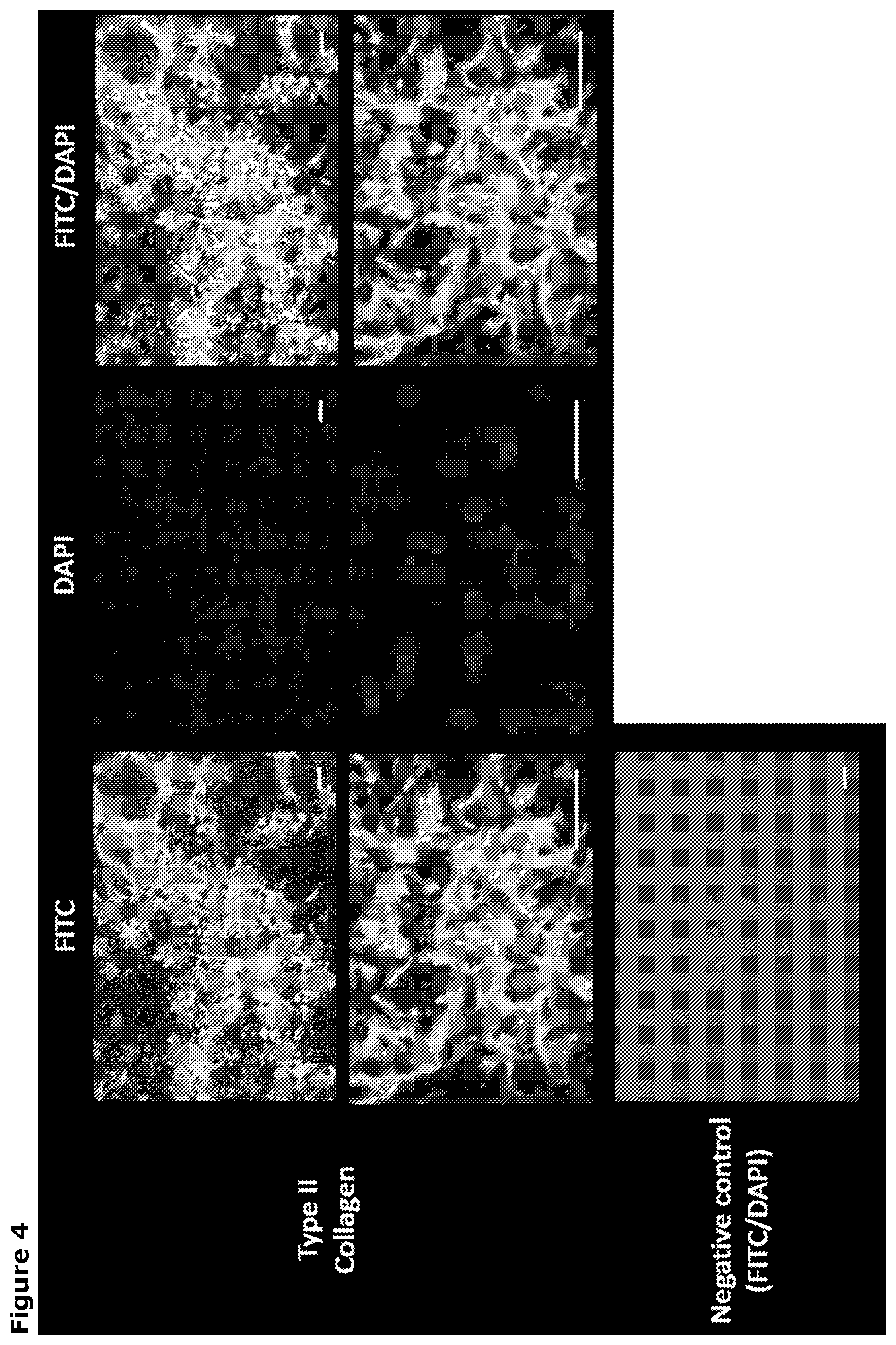 Patent US12569518 Figure 4 – Cartilage tissue