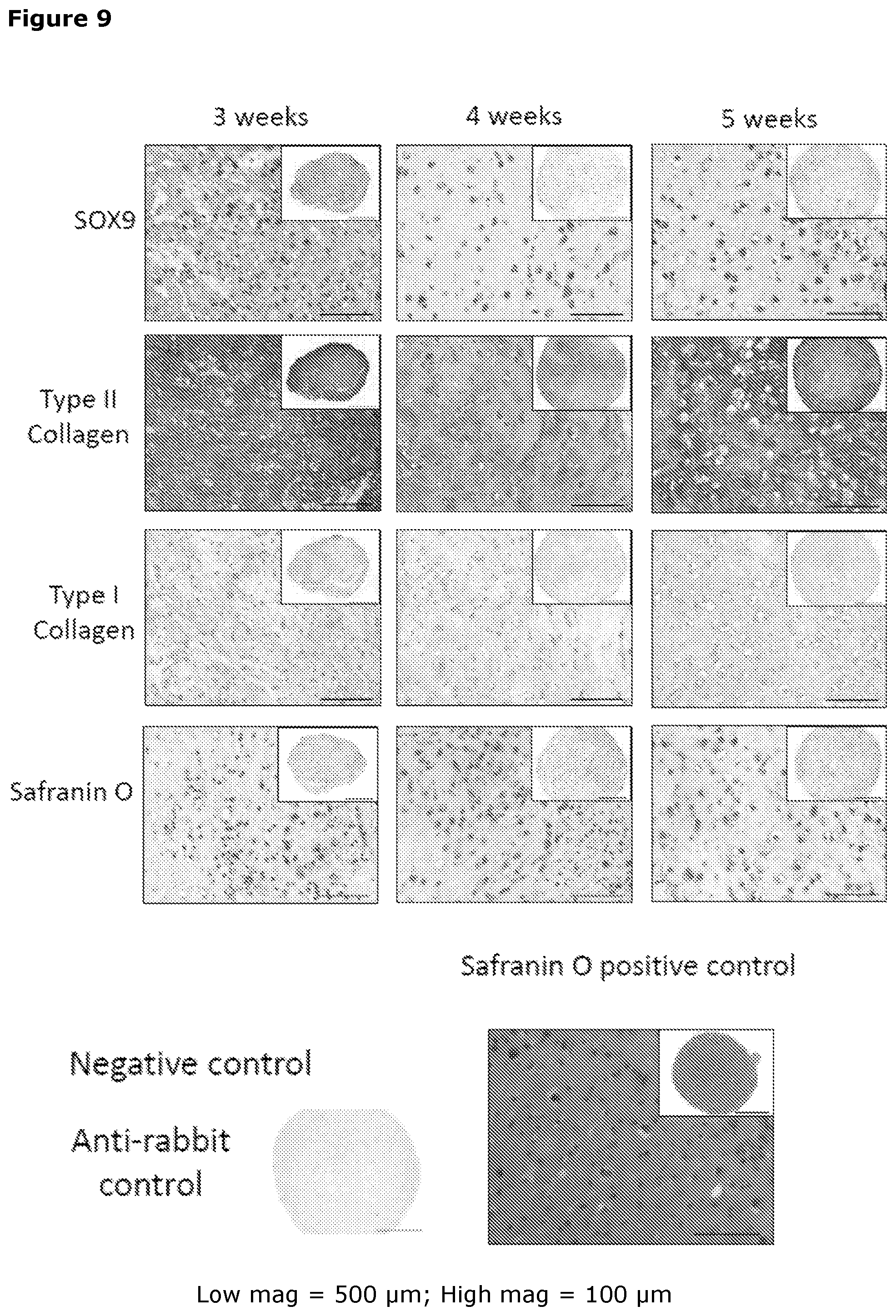 Patent US12569518 Figure 11 – Cartilage tissue