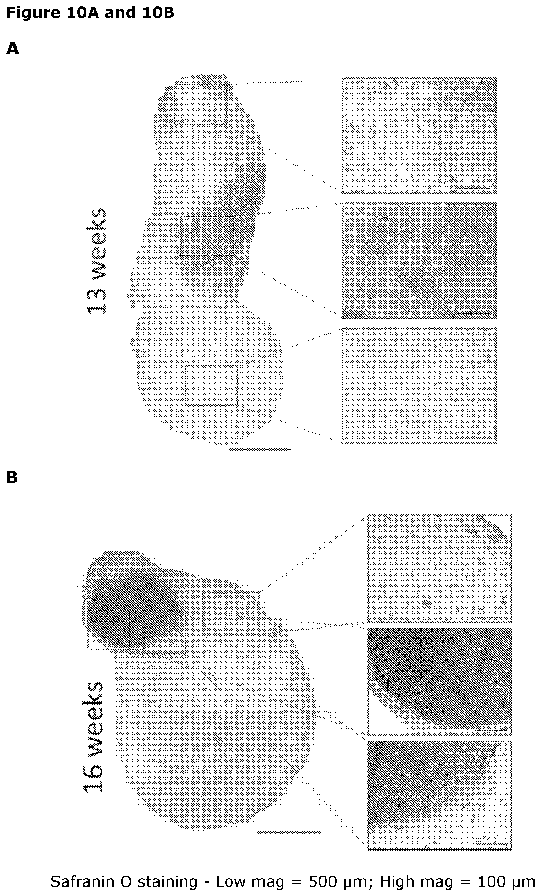 Patent US12569518 Figure 12 – Cartilage tissue