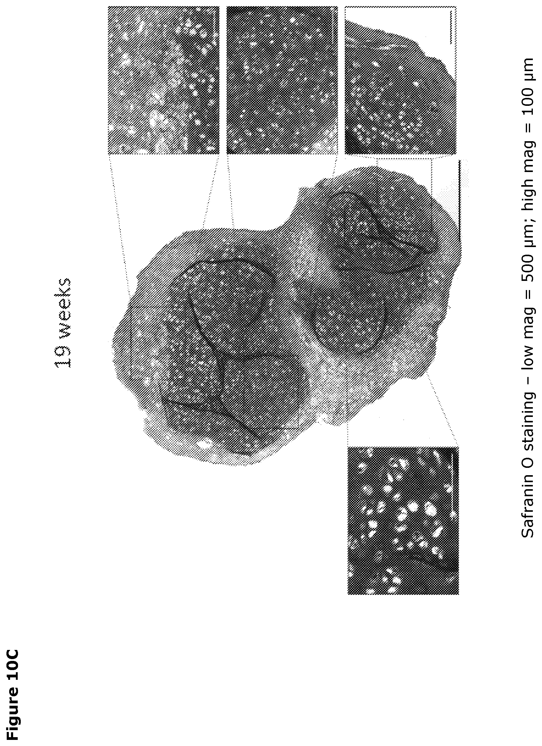 Patent US12569518 Figure 13 – Cartilage tissue