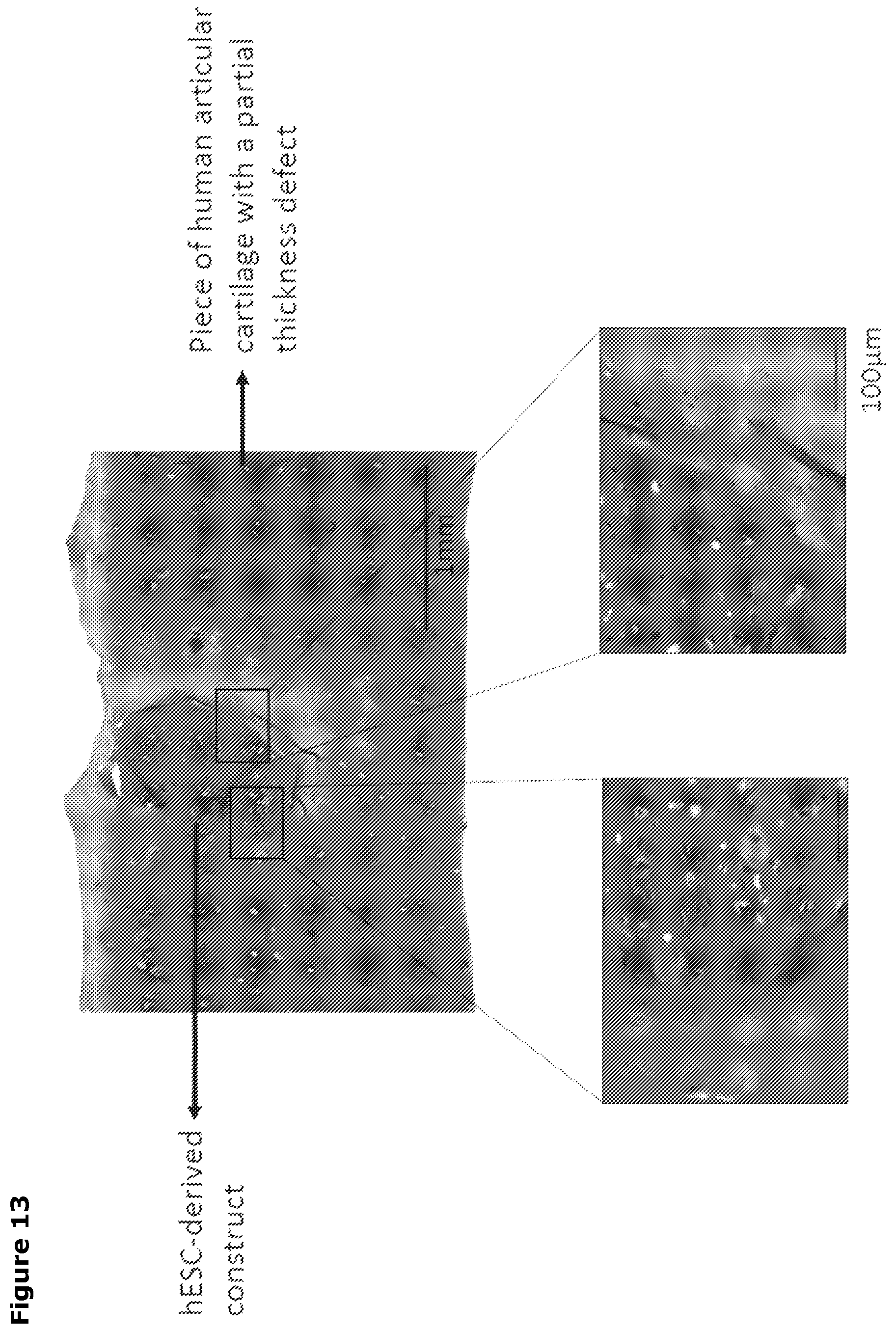 Patent US12569518 Figure 17 – Cartilage tissue