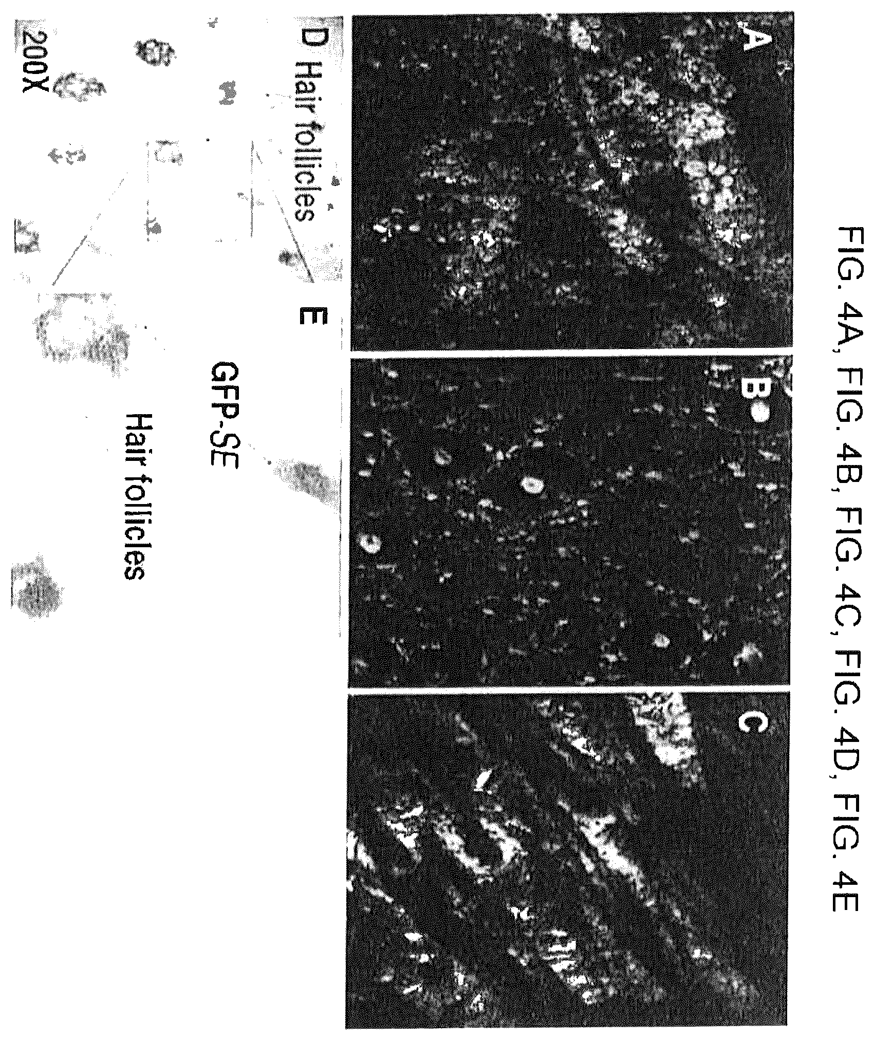 Patent US12569521 Figure 7 – Methods and compositions for treating inflammatory skin disease with recombinant microorganisms