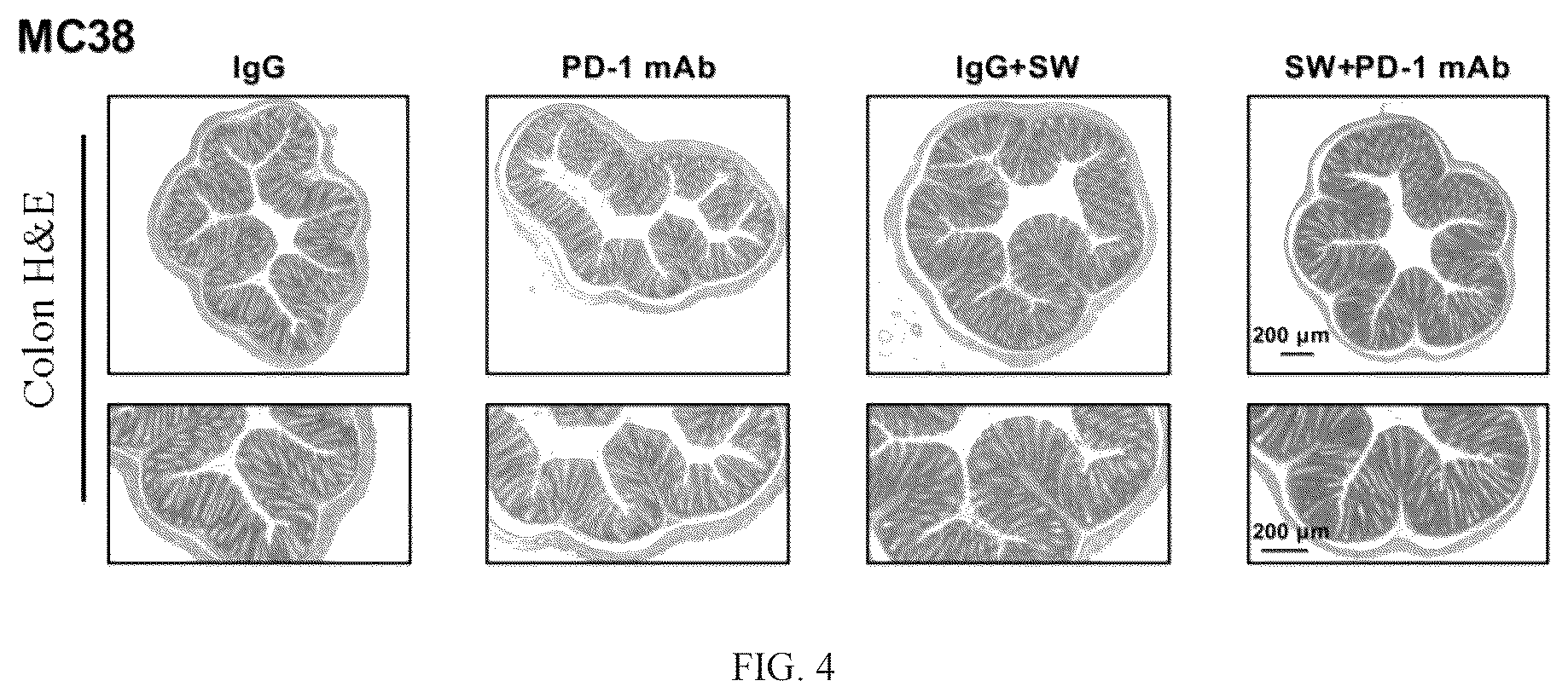 Patent US12569522 Figure 4 – Pharmaceutical composition comprising Sutterella wadsworthensis and immune checkpoint inhibitors for treatment of colon cancer