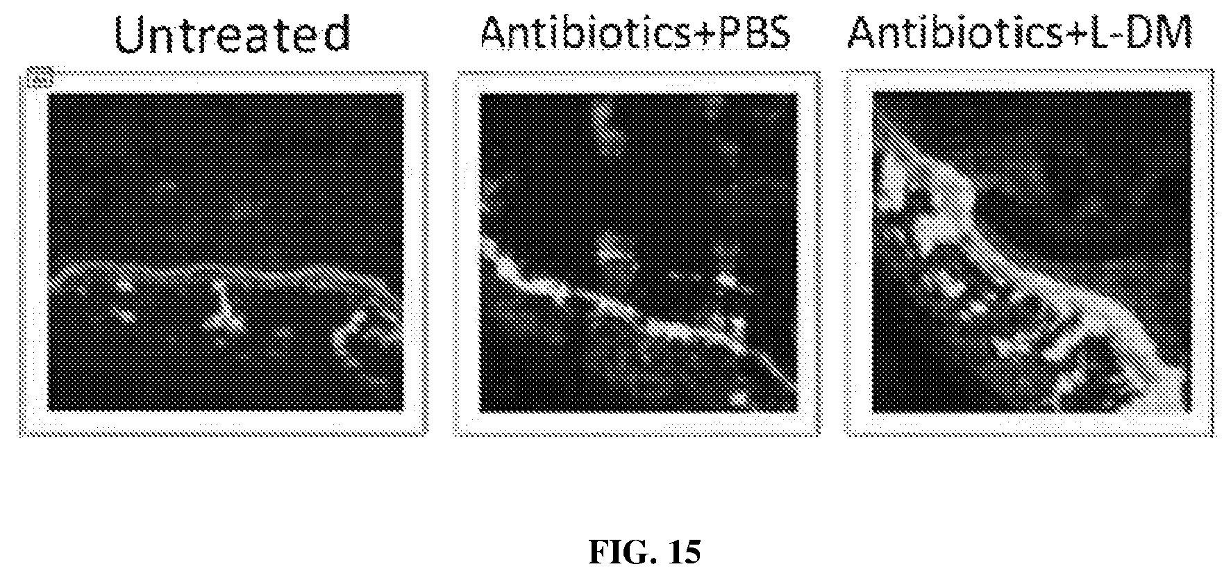 Patent US12569524 Figure 10 – Compositions and methods for preventing and treating antibiotic induced pathologies using probiotics in the biofilm state